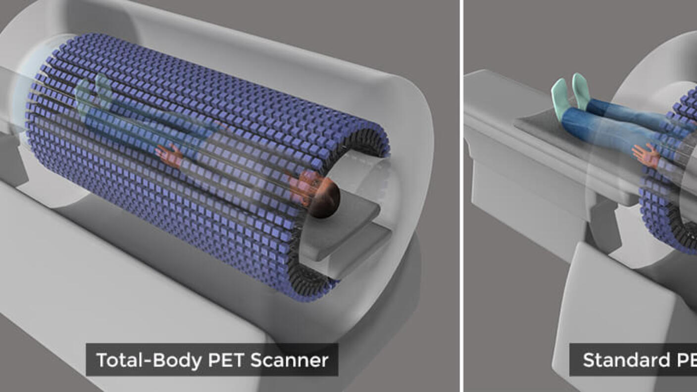 Diagram showing a full-body PET scan and a standard PET scan.