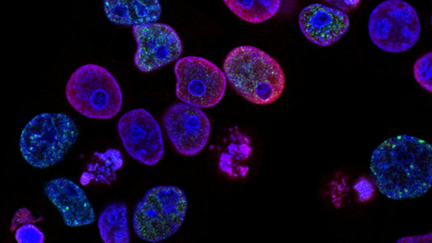 Photo of cells with treatment-induced DNA damage, marked by red staining