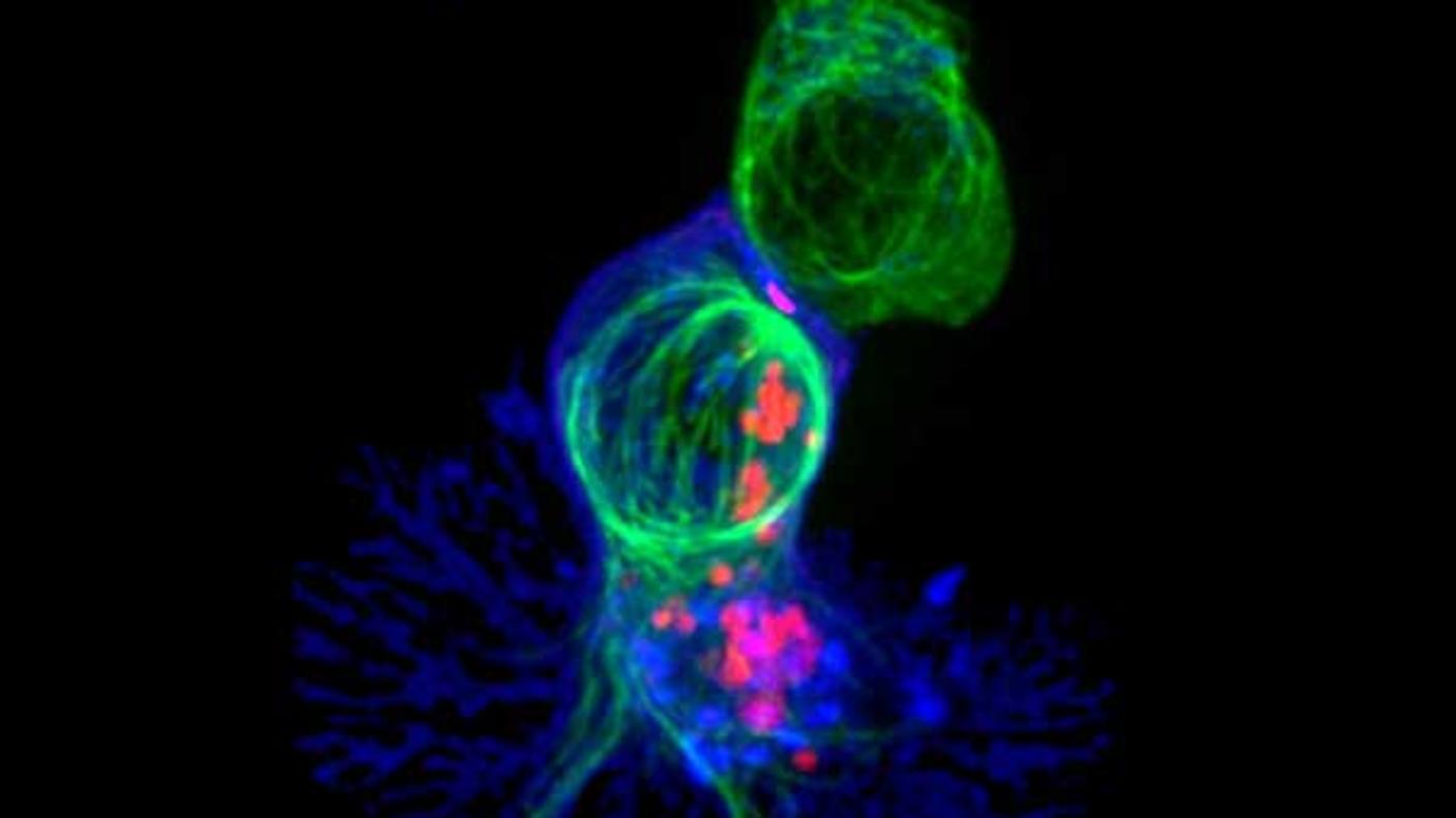 A killer T cell (blue) engaging a target cell, with cell-killing molecules (red) traveling along the target cell's cytoskeleton (green).