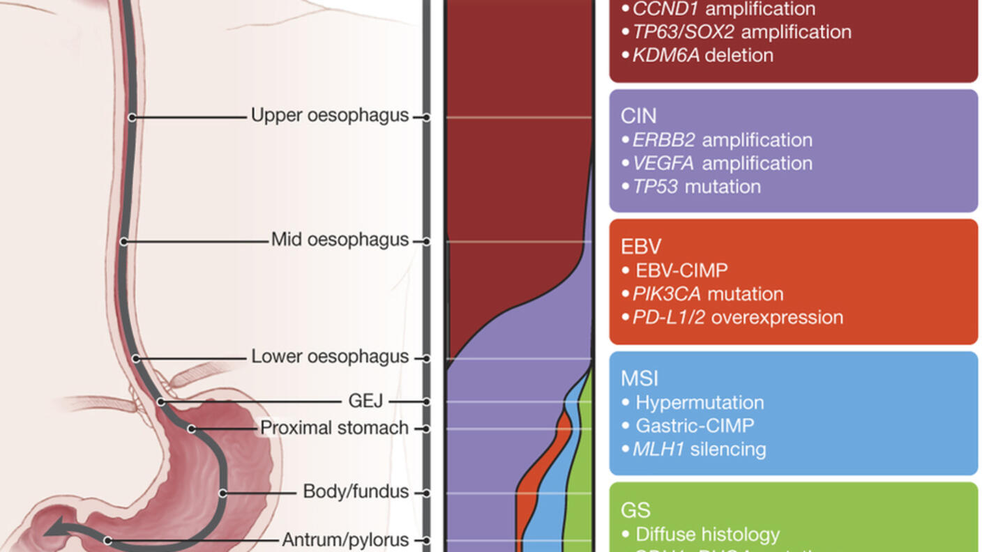 Illustration of an esophagus