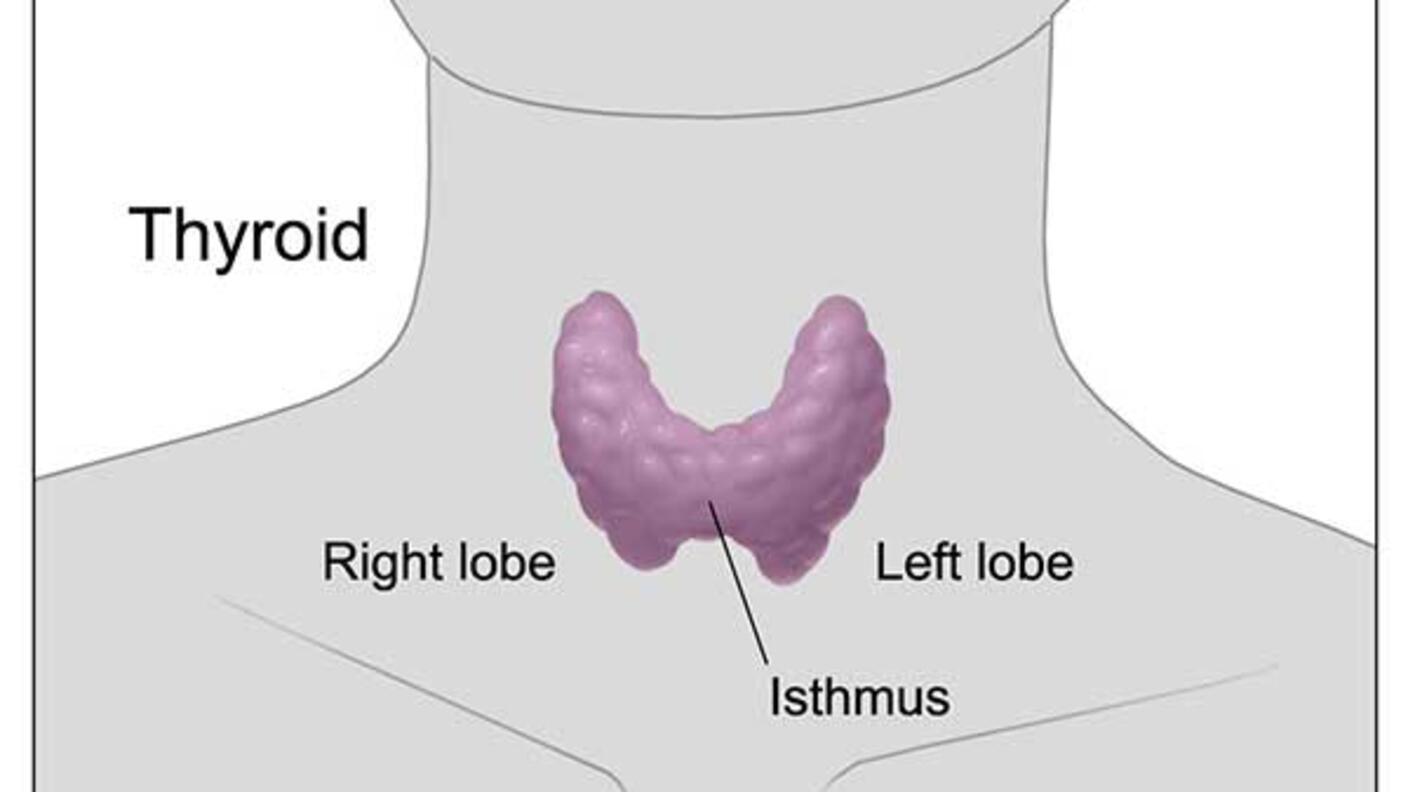 Schematic of a thyroid gland.