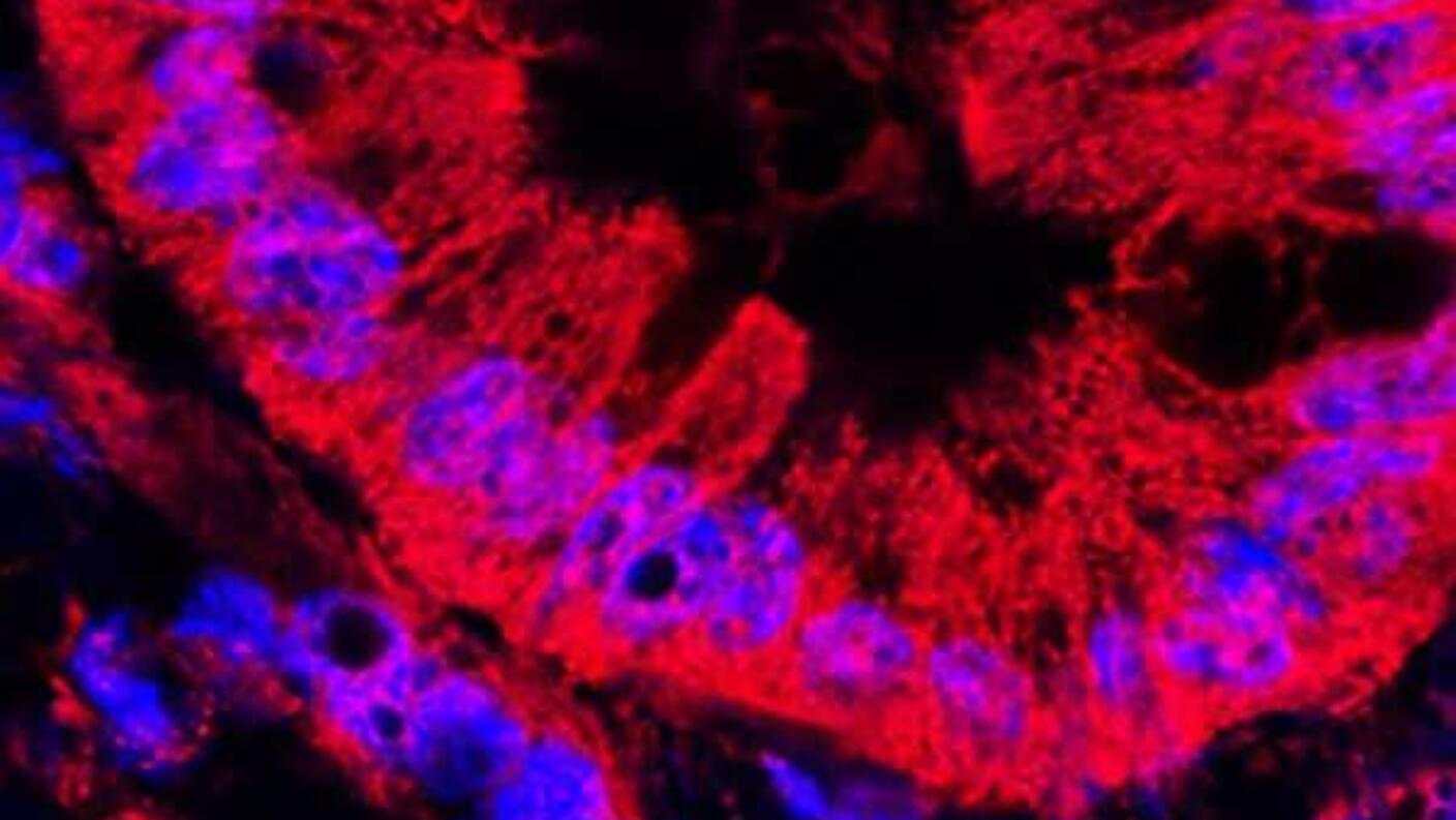 An irregular donut-shape (mitochondria) is mostly red with some blue highlights on a black background.