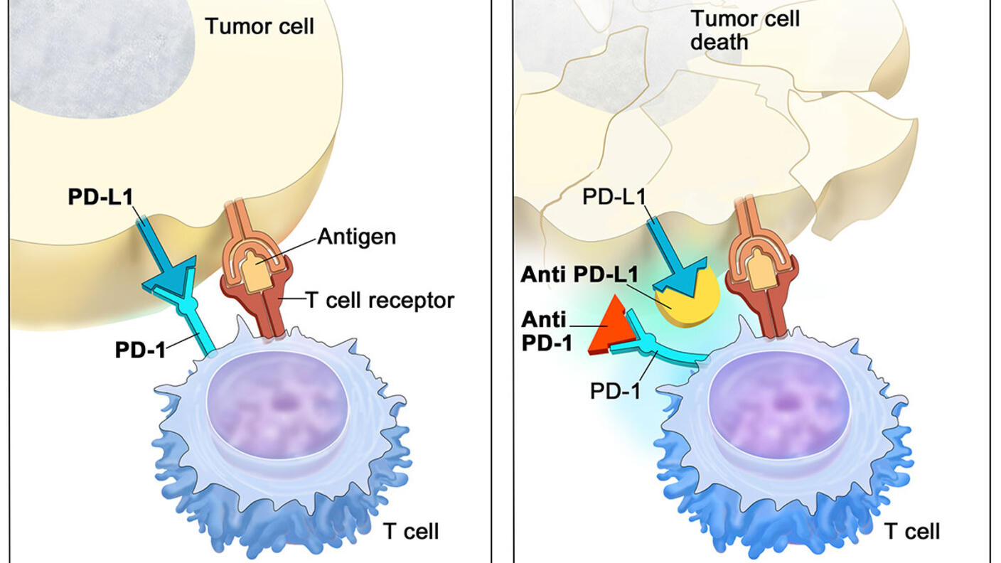 Two-panel illustration showing the interaction between T cells and tumor cells. The left panel is titled "PD-L1 binds to PD-1 and inhibits T cell killing of tumor cell" and shows an antigen and T cell receptor, illustrating the inhibition of T cell activity. The right panel is titled "Blocking PD-L1 or PD-1 allows T cell killing of tumor cell" and shows tumor cell death, indicating successful T cell activity.