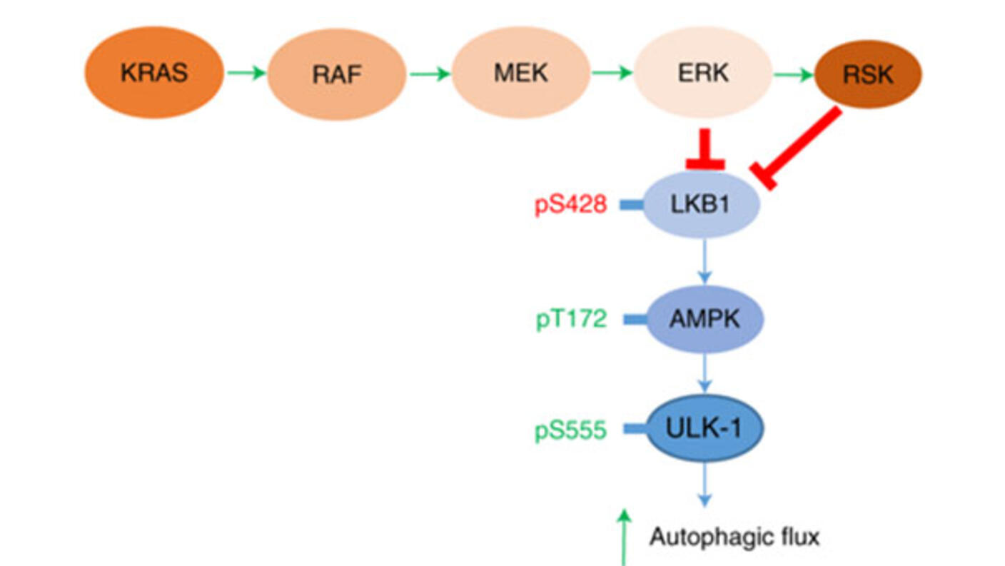 Diagram of KRAS signaling pathway.