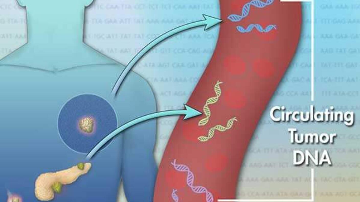 Illustration depicting the concept of circulating tumor DNA (ctDNA). It shows a human figure with highlighted organs, where tumor DNA originates. Arrows point from the tumors to a large, stylized blood vessel, where DNA strands are illustrated floating. The background features a sequence of DNA code, emphasizing the genetic aspect of cancer detection and monitoring.