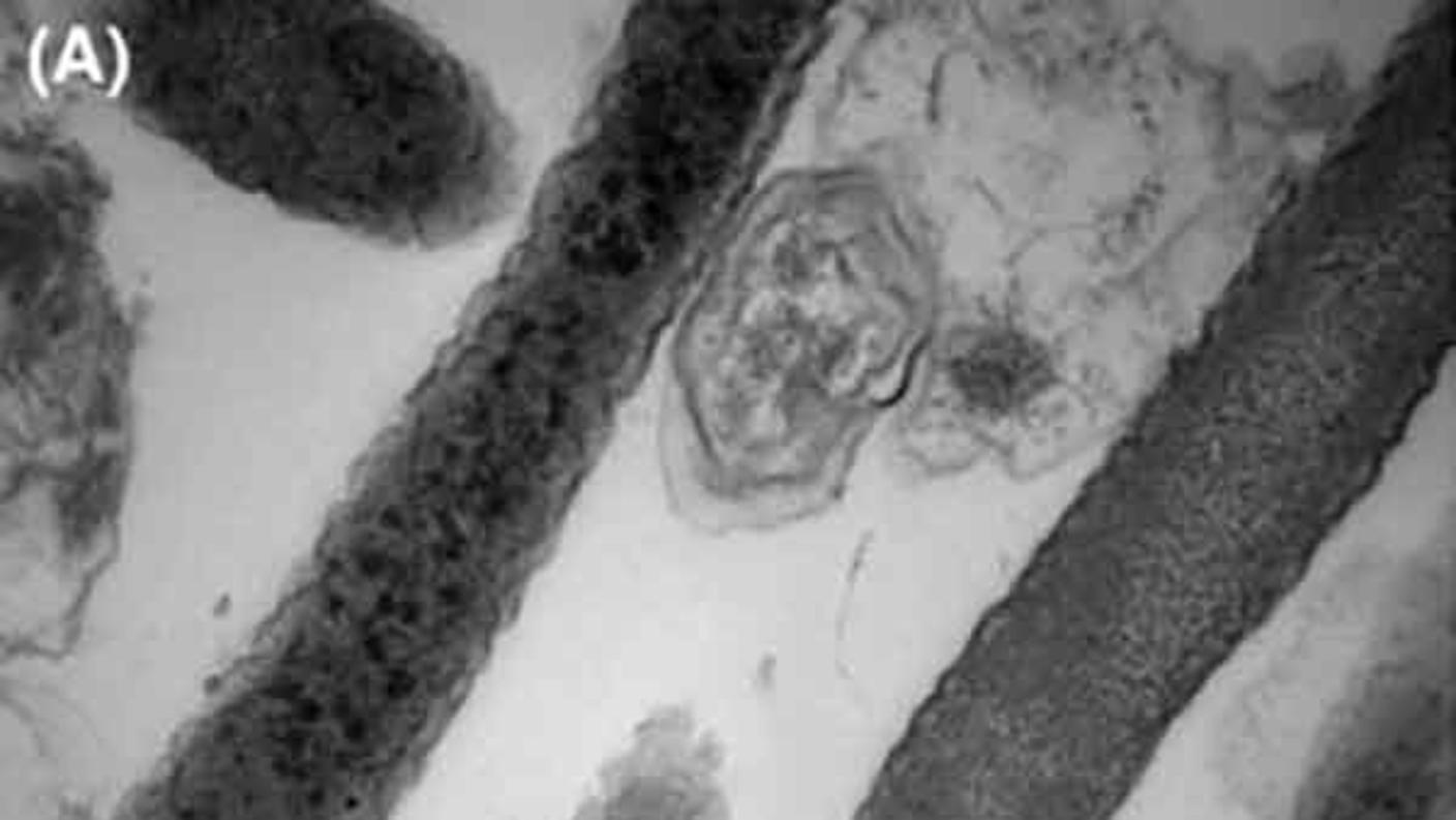 Electron micrograph of Fusobacterium nucleatum, a bacterium linked to colorectal cancer growth and spread.