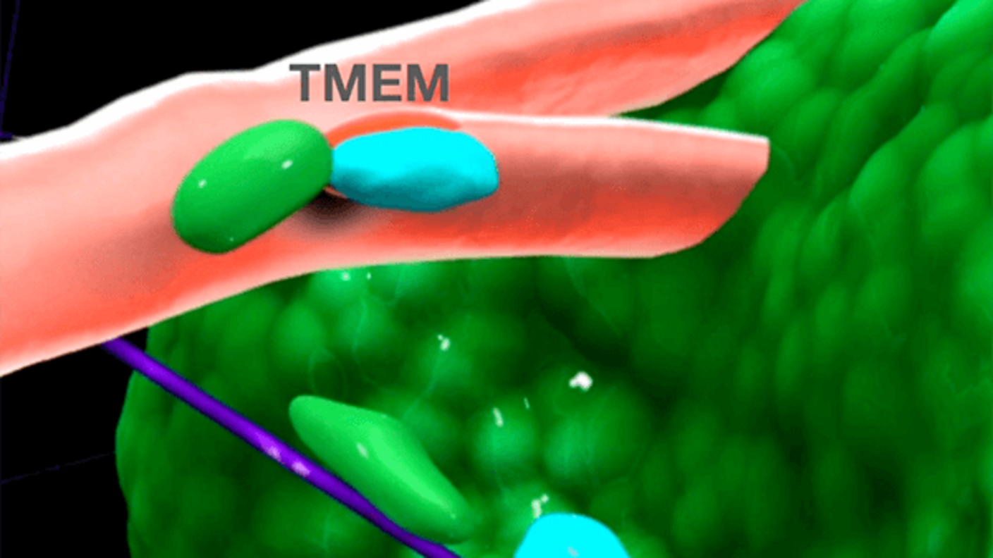 Illustration of TMEM chemo induced metastasis