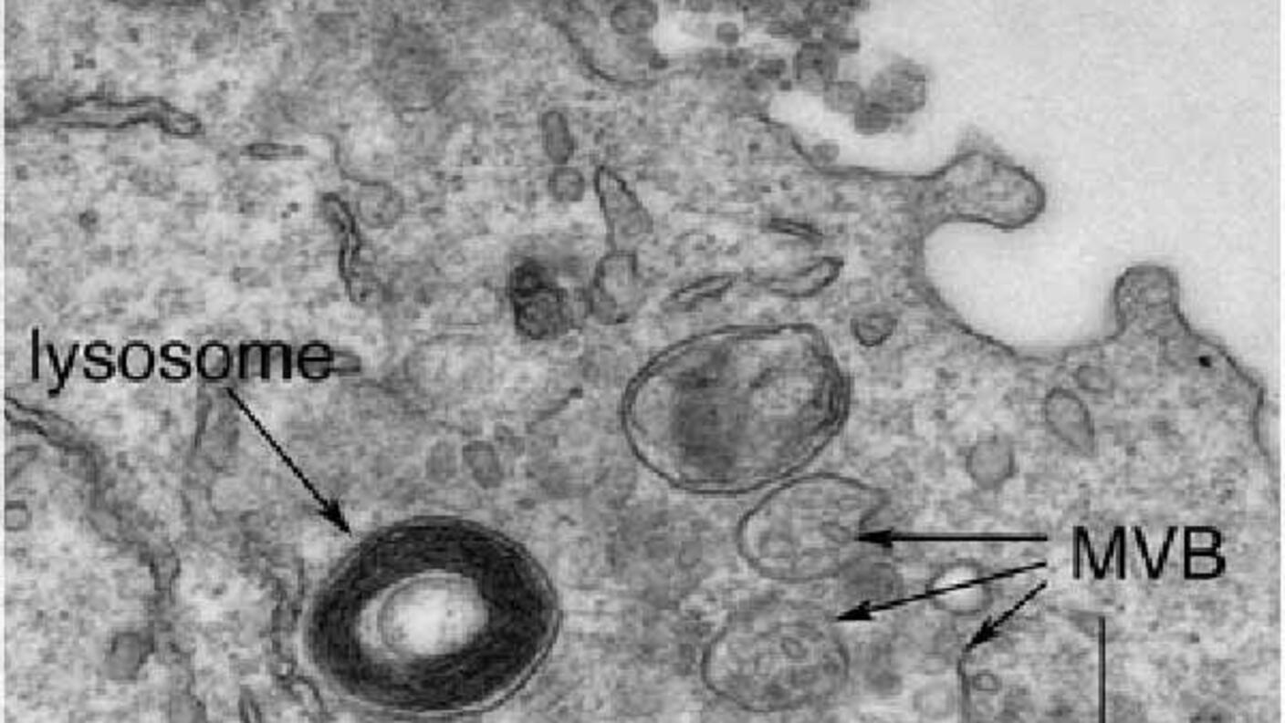A transmission electron micrograph of a cancerous B cell that has secreted exosomes.