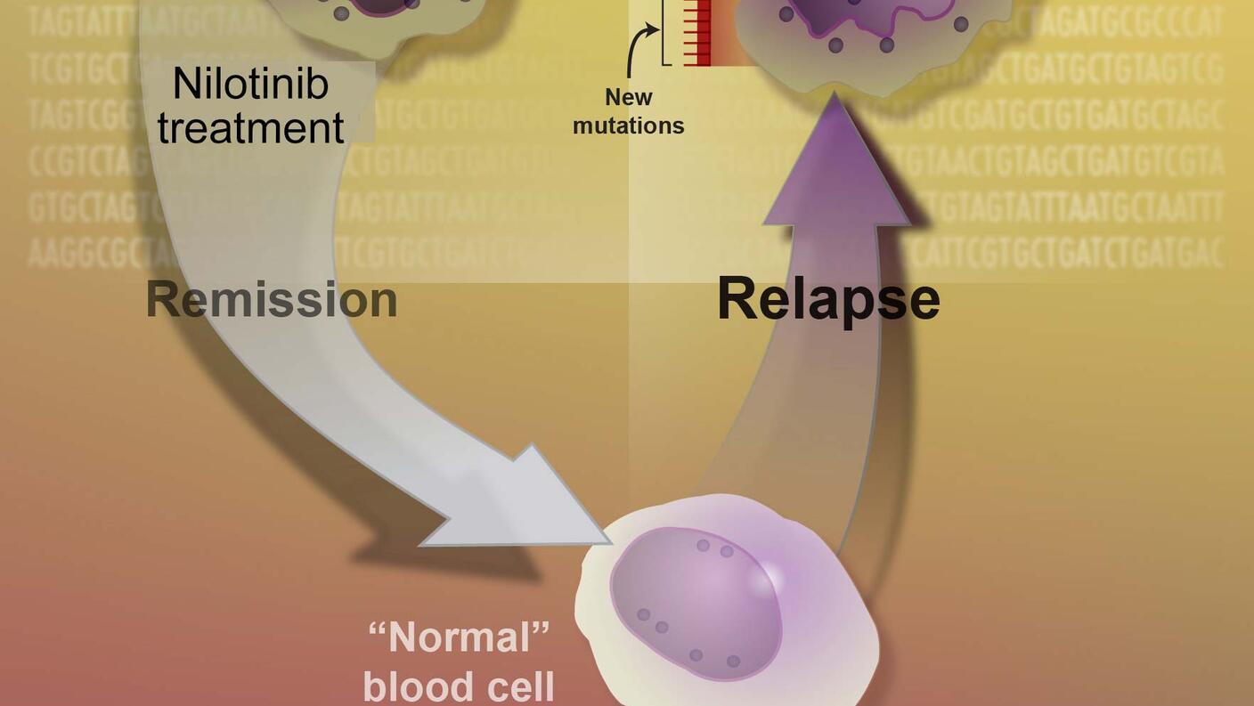 Illustration showing how nilotinib inhibits the BCR-ABL protein in chronic myeloid leukemia cells, leading to reduced cancer cell proliferation.