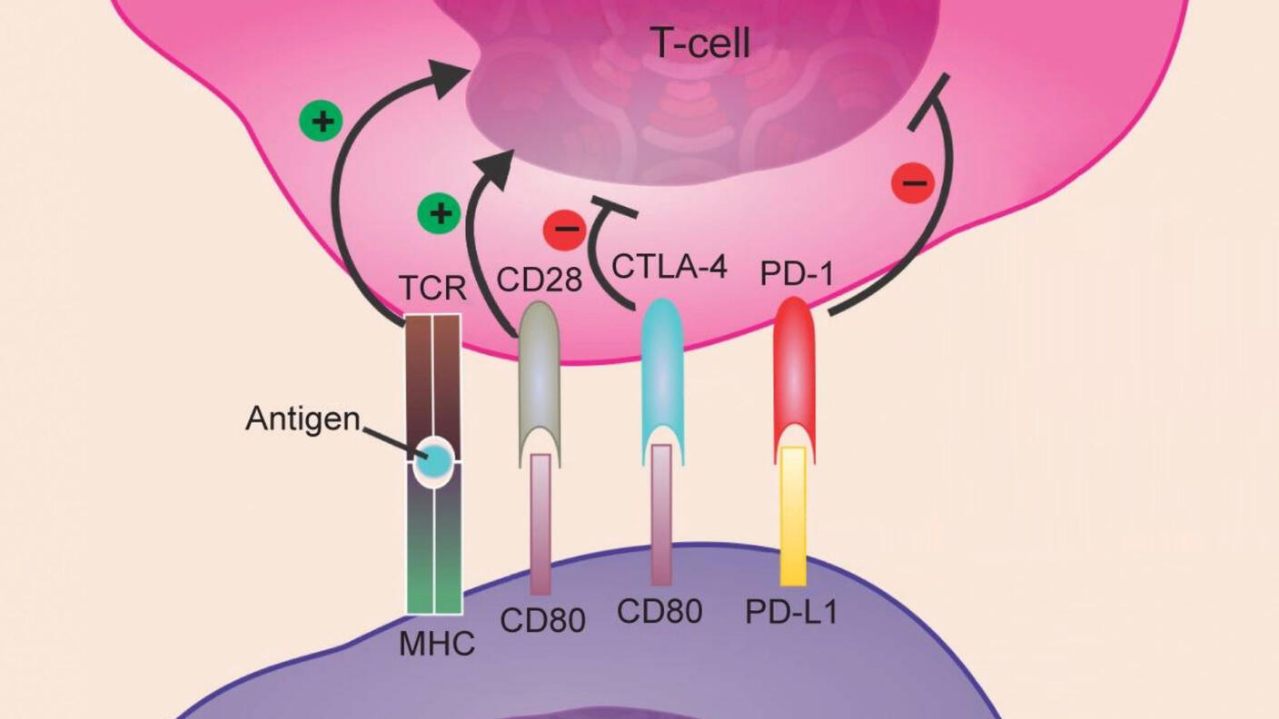 Interaction between a T cell and cancer cell with atezolizumab. Four shapes link the two cells. The first is labeled TCR in the T cell and MHC in the cancer cell. Antigen is also labeled in the center. The second has CD28 for the T cell, CD 80 for the cancer cell. The third has CTLA-4 and CD80, and the four has PD-1 and PD-L1 in the T and cancer cell regions respectively. Arrows with plus signs point at the T cell from the TCR and CD28 connectors; the CTLA-4 and PD-1 connectors have a minus sign.