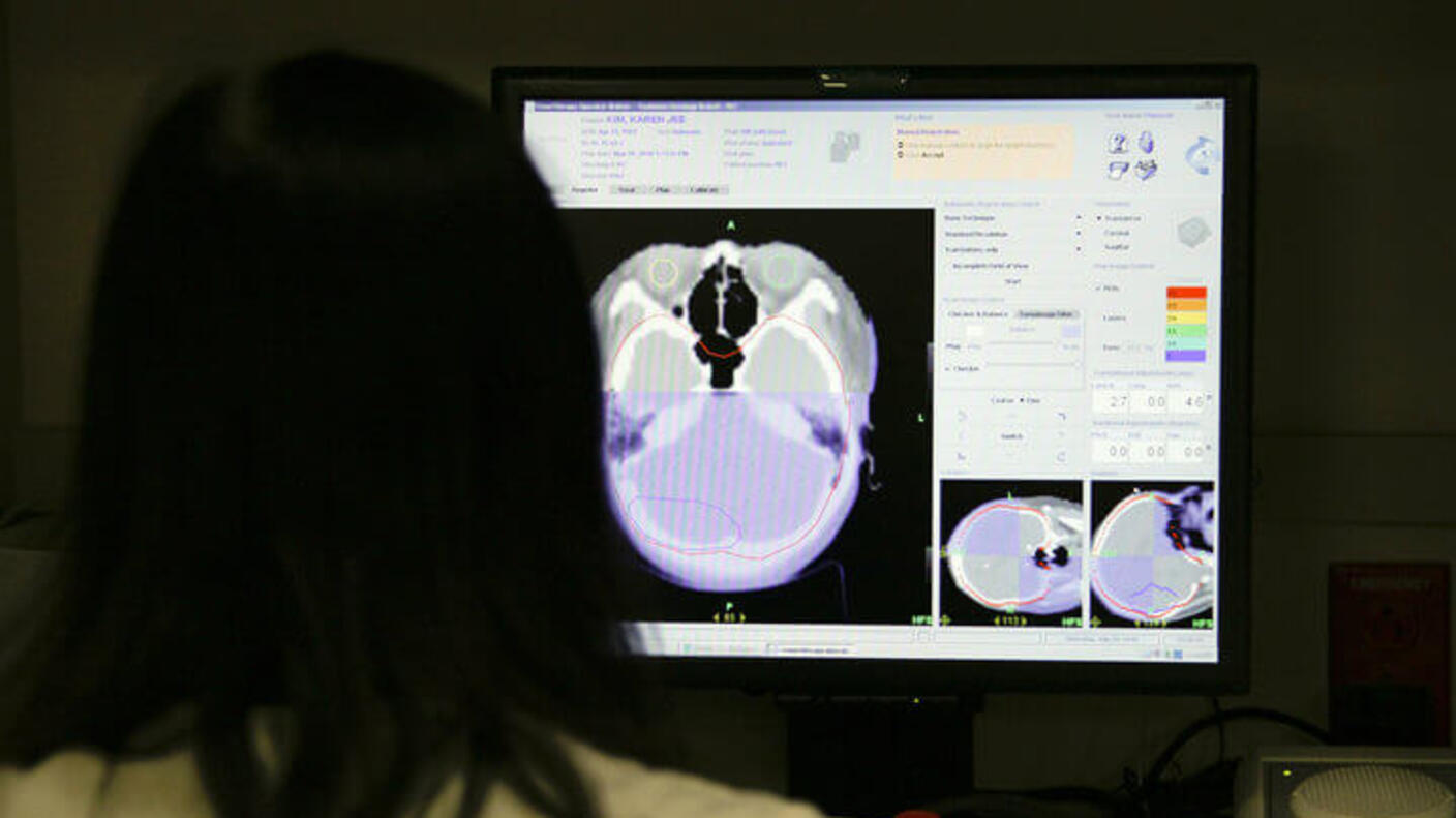 Medical professional reviewing brain scan images on computer screen to create a treatment plan for a brain tumor patient, with the colorized scan showing brain anatomy in purple and white.