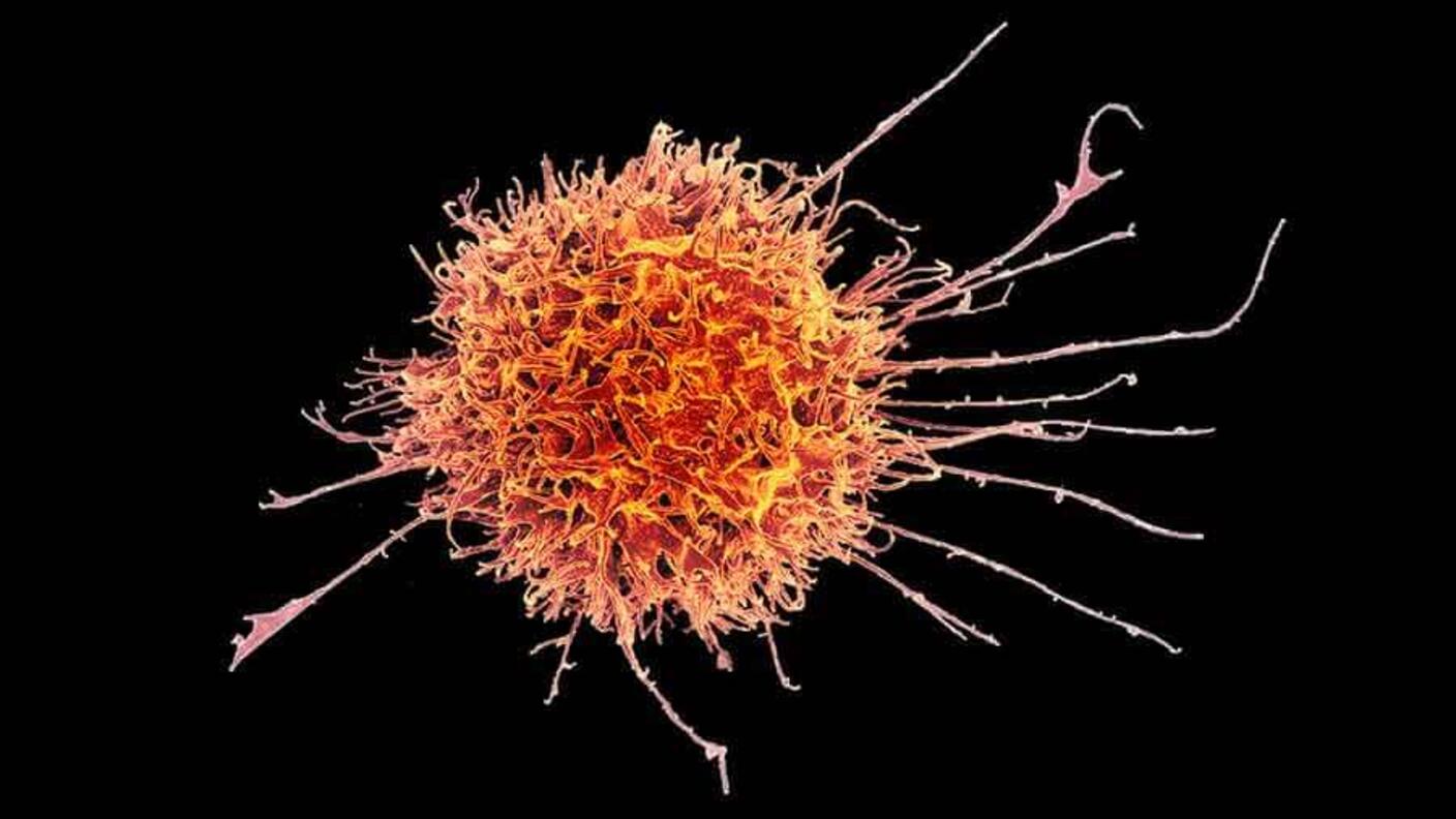 An orange cell with yellow highlights on a black background. The cell is round and has an intricate, lumpy exterior, There are random, long, thin strings coming off the cell surface, mostly on the right hand side. On these strings, small spikes and bumps extrude.