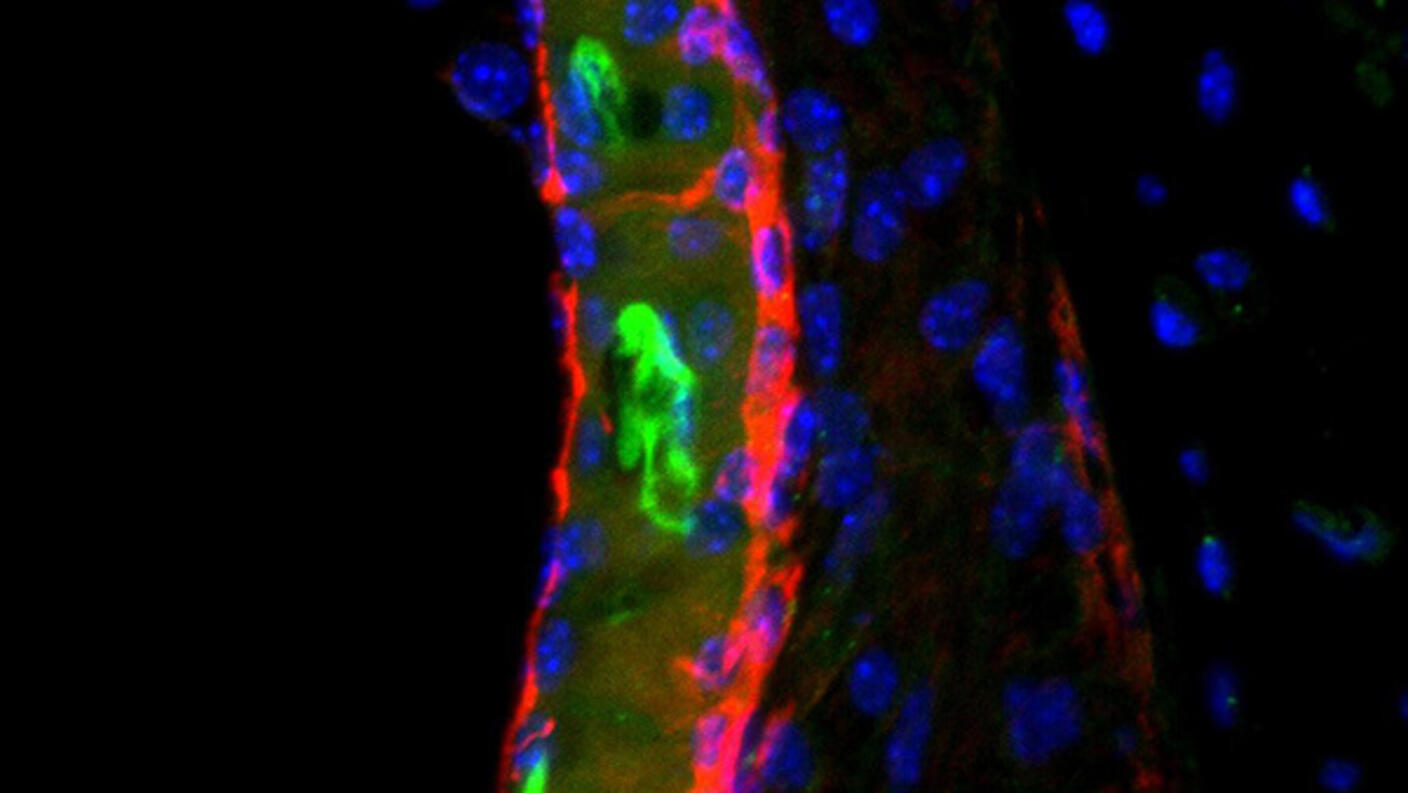 Microscopic view of a mouse inner ear showing cisplatin drug in green.