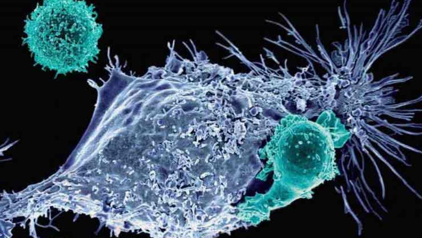 Image of CAR T cells attacking a cancer cell.
