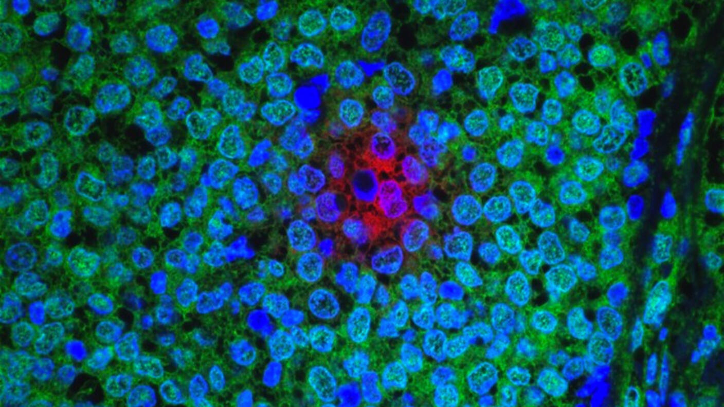 Fluorescent microscopy image of tissue showing a dense arrangement of cells. The cells are stained with various colors: bright blue, green, and a prominent cluster of red near the center. The vibrant colors highlight different cellular components or markers, providing insight into the tissue's structure and function.