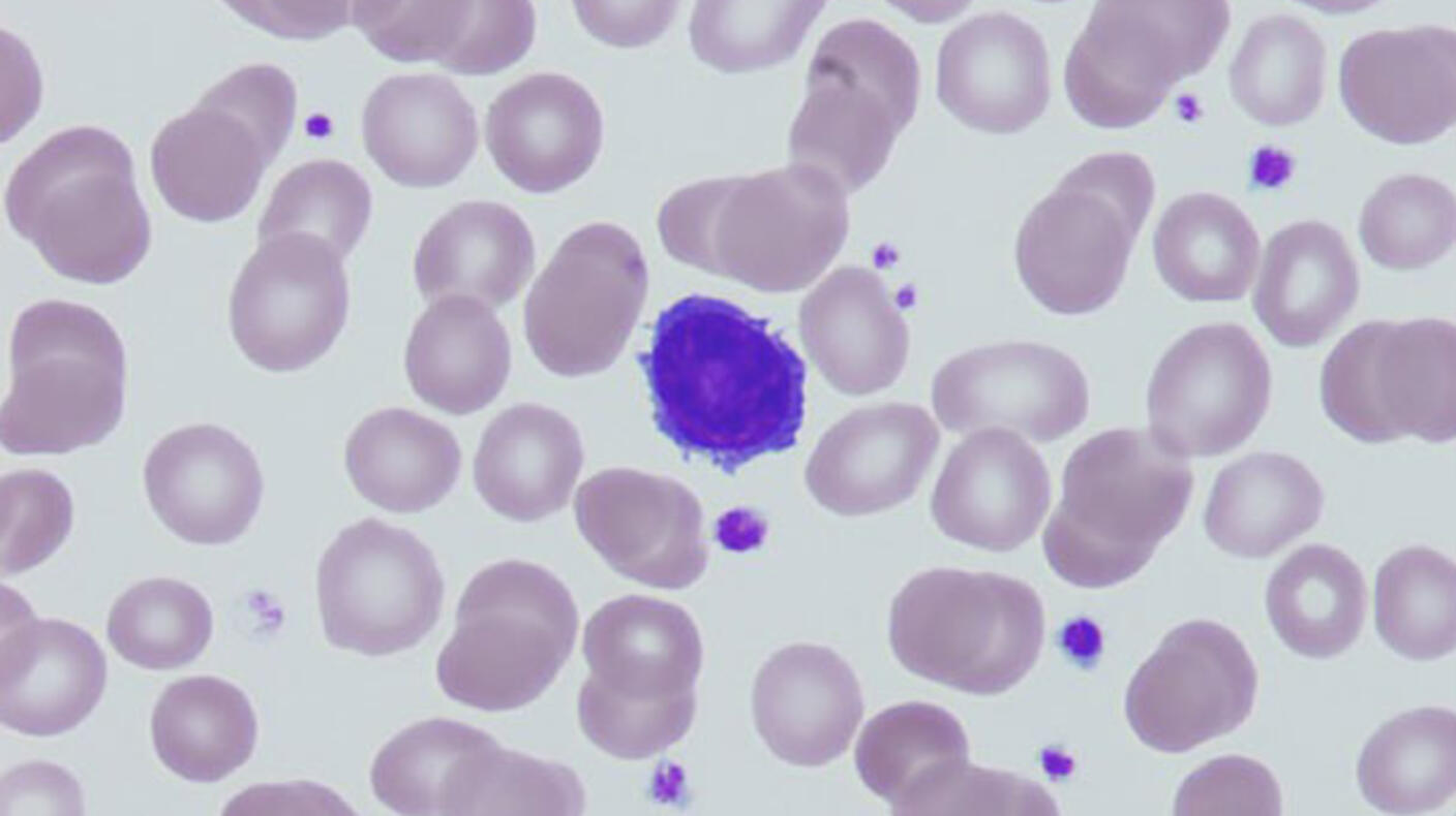 Microscopic image of blood cells, featuring numerous light purple, round cells scattered across the view. Among them, a few darker purple cells stand out, highlighting different types of cells within the sample. 
