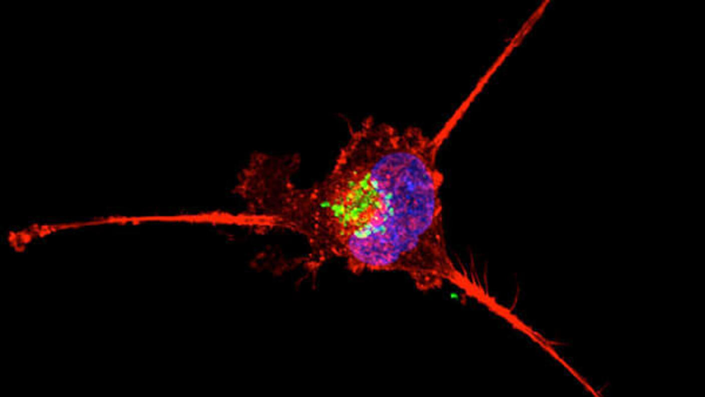 A vivid microscopy image of a single cell on a black background. The cell features a bright blue nucleus with green spots inside it, surrounded by red extensions that spread outwards. 