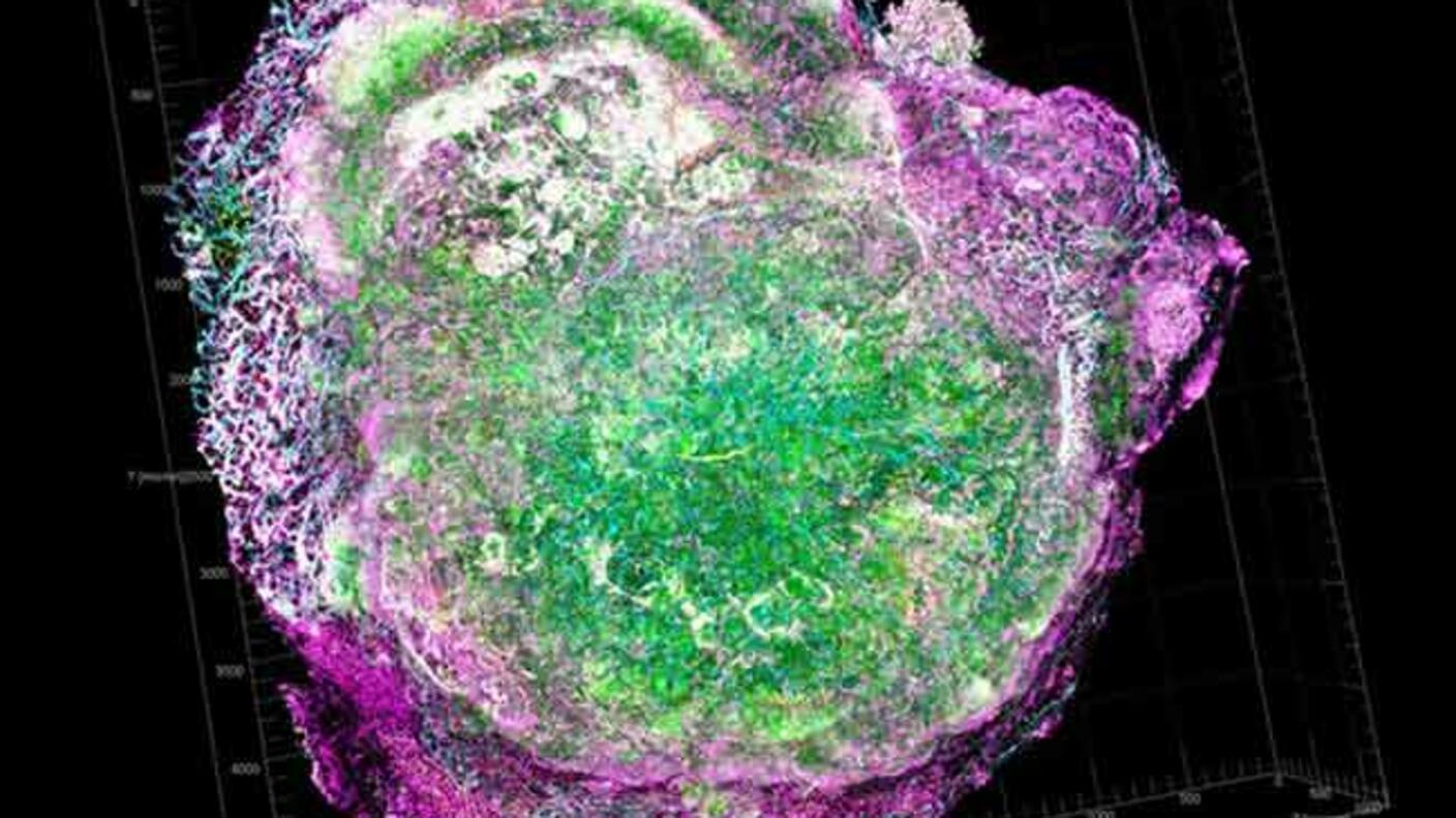3D digital reconstruction of a mouse cell overexpressing the HER2 protein (shown in green) surrounded by purple cellular structures, demonstrating the protein associated with aggressive breast cancers.