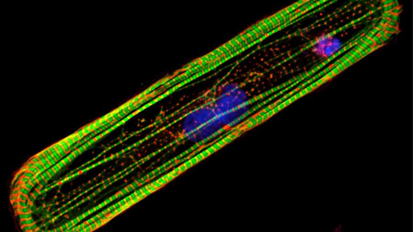 Microscopic image of stem cell-derived heart muscle cell. 