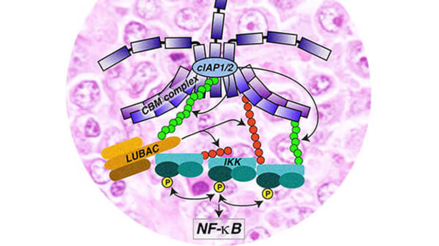 Illustration of a complex signaling pathway overlaid on a background of stained cells. It depicts the activation of the NF-kB pathway, featuring components like the CBM complex, cIAP1/2, LUBAC, and IKK, represented in various colors. Arrows indicate the flow of signaling events, highlighting the interactions that lead to NF-kB activation.
