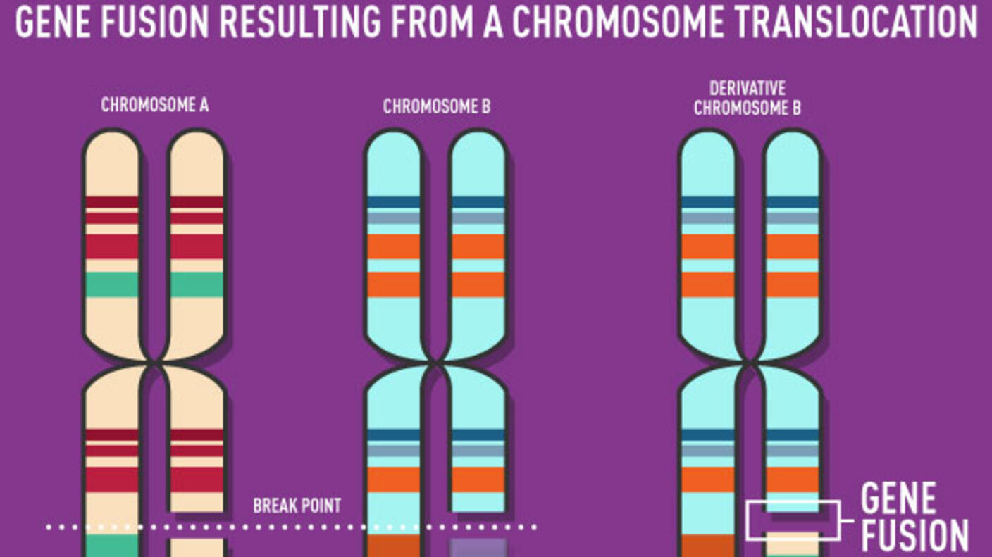 Image of three sets of chromosomes with gene fusion resulting from a chromosome translocation.