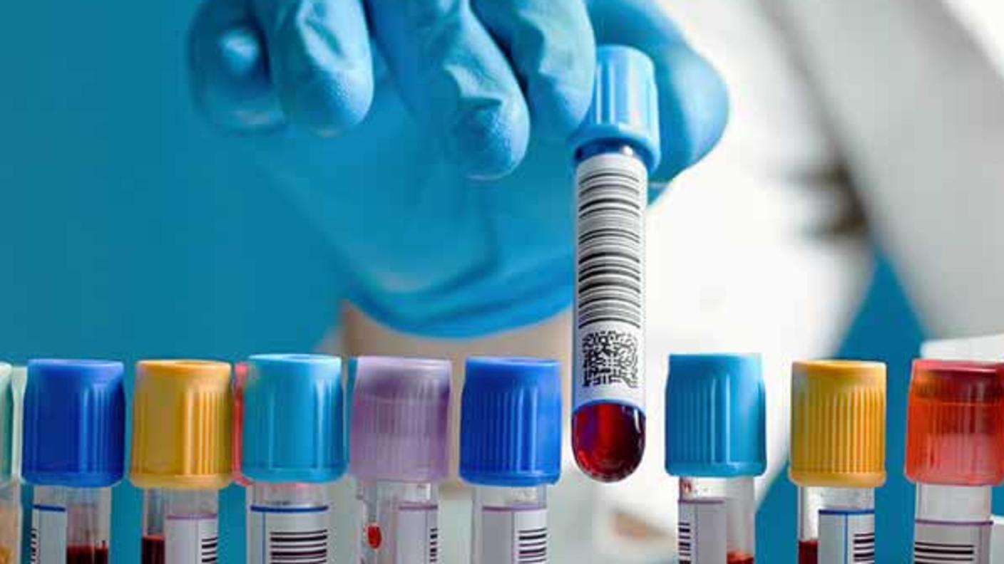 Gloved hand picking up a capped vial of blood from a tray holding additional capped vials.