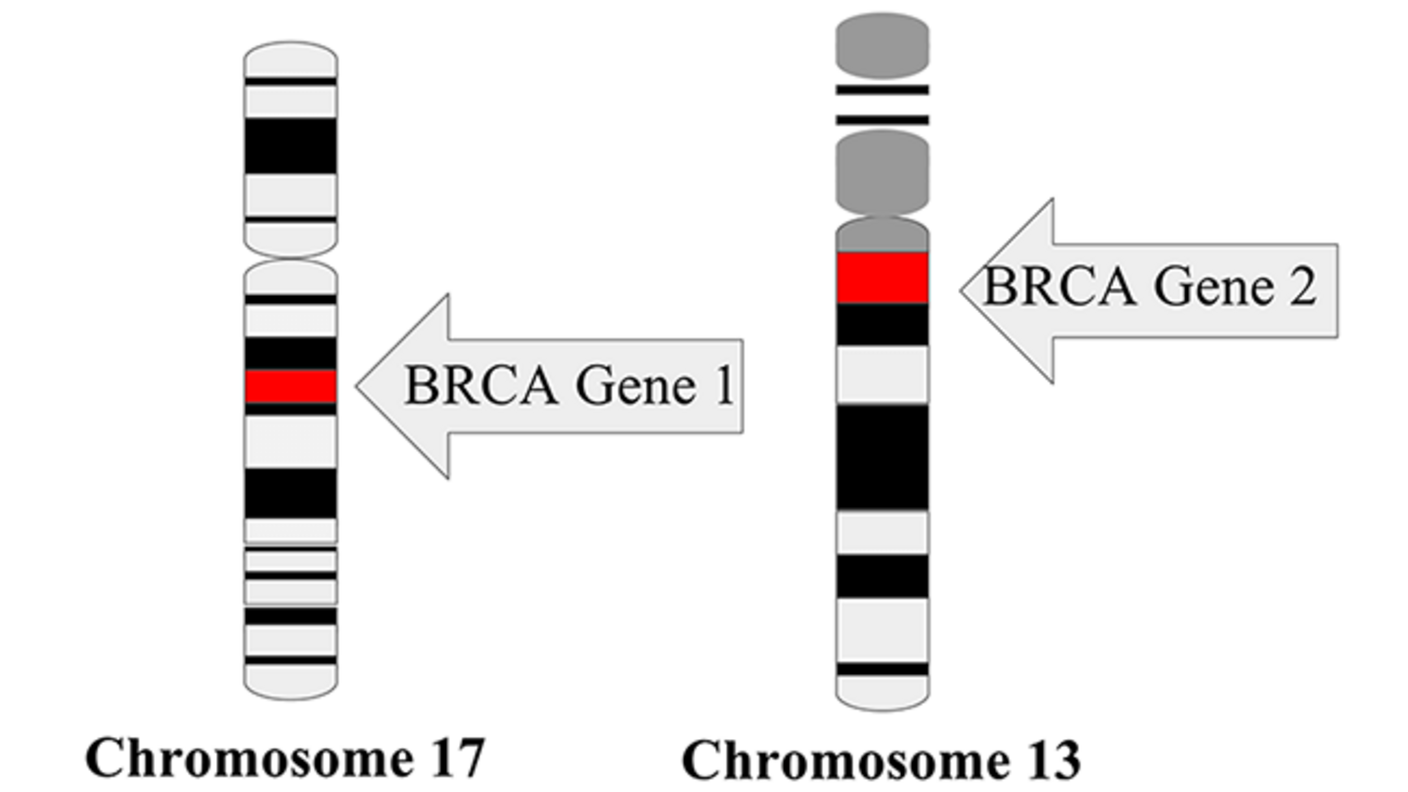 Illustration of BRCA Gene 1 (chromosome 17) and BRCA Gene 2 (chromosome 13)