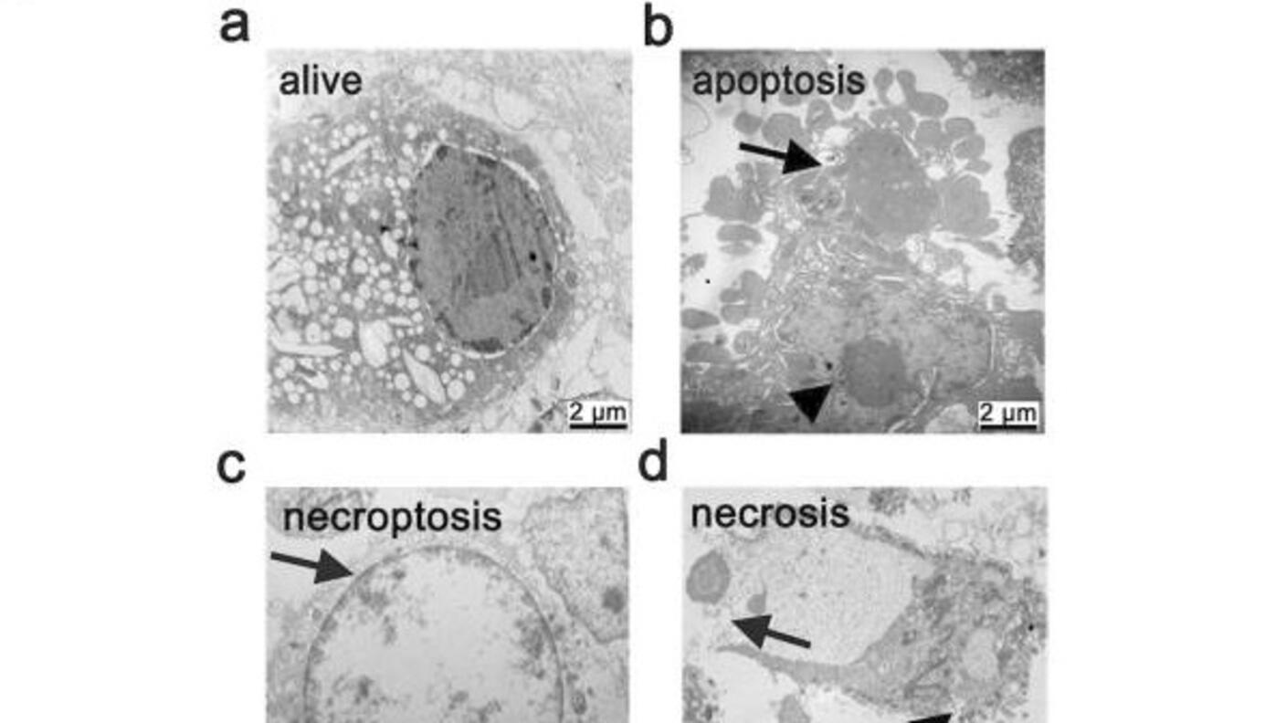 Microscope images showing a live cell and cells undergoing apoptosis, necroptosis, and necrosis.