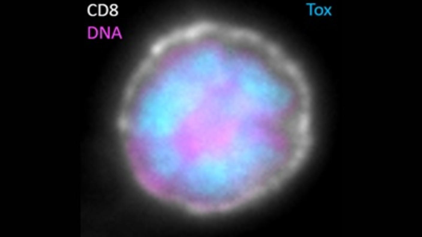 Image of an exhausted T cell with blue staining showing TOX in the cell nucleus.