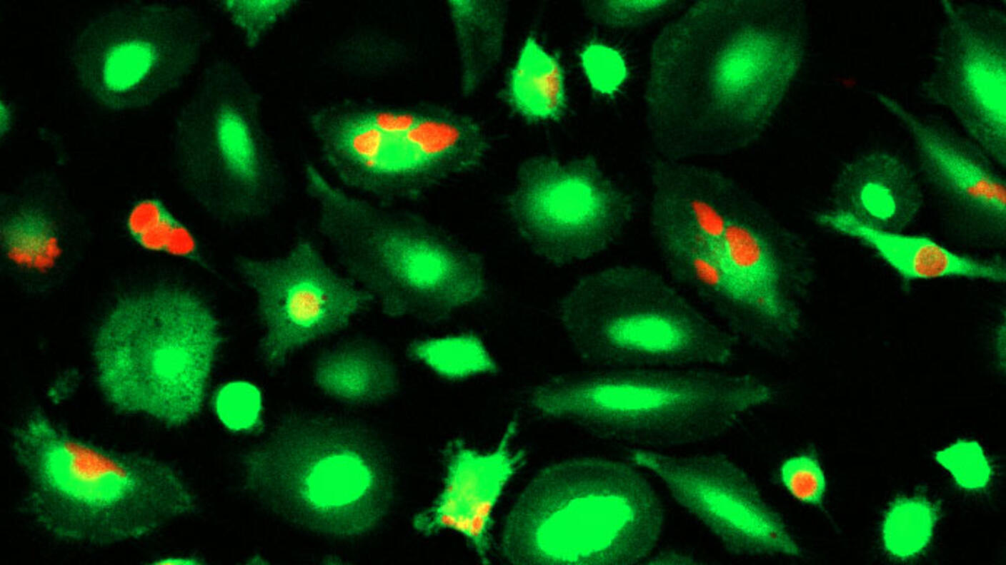 Microscope images of macrophage immune cells that have engulfed breast cancer cells treated with a CD24-blocking antibody.