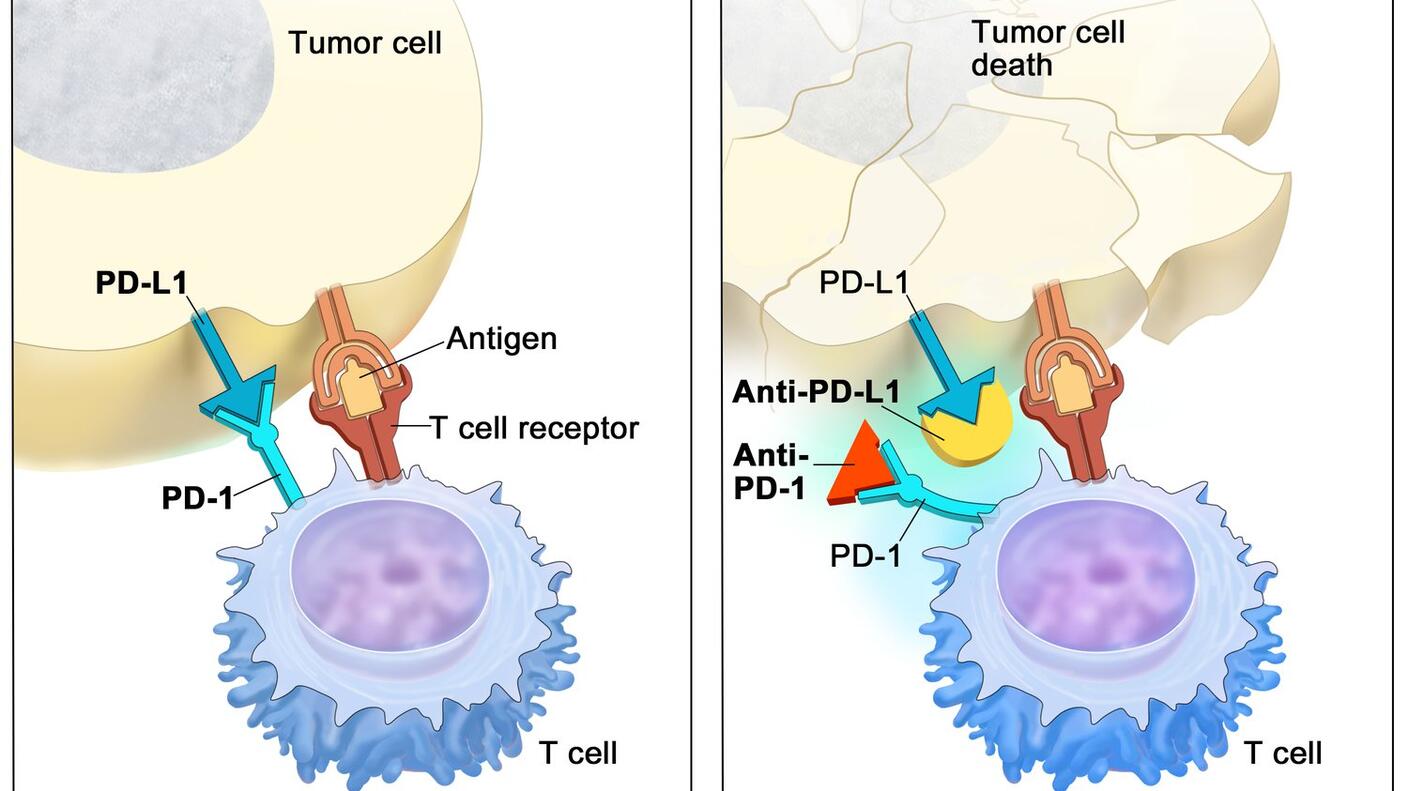 Two-panel illustration showing the interaction between T cells and tumor cells. The left panel is titled "PD-L1 binds to PD-1 and inhibits T cell killing of tumor cell" and shows an antigen and T cell receptor, illustrating the inhibition of T cell activity. The right panel is titled "Blocking PD-L1 or PD-1 allows T cell killing of tumor cell" and shows tumor cell death, indicating successful T cell activity.