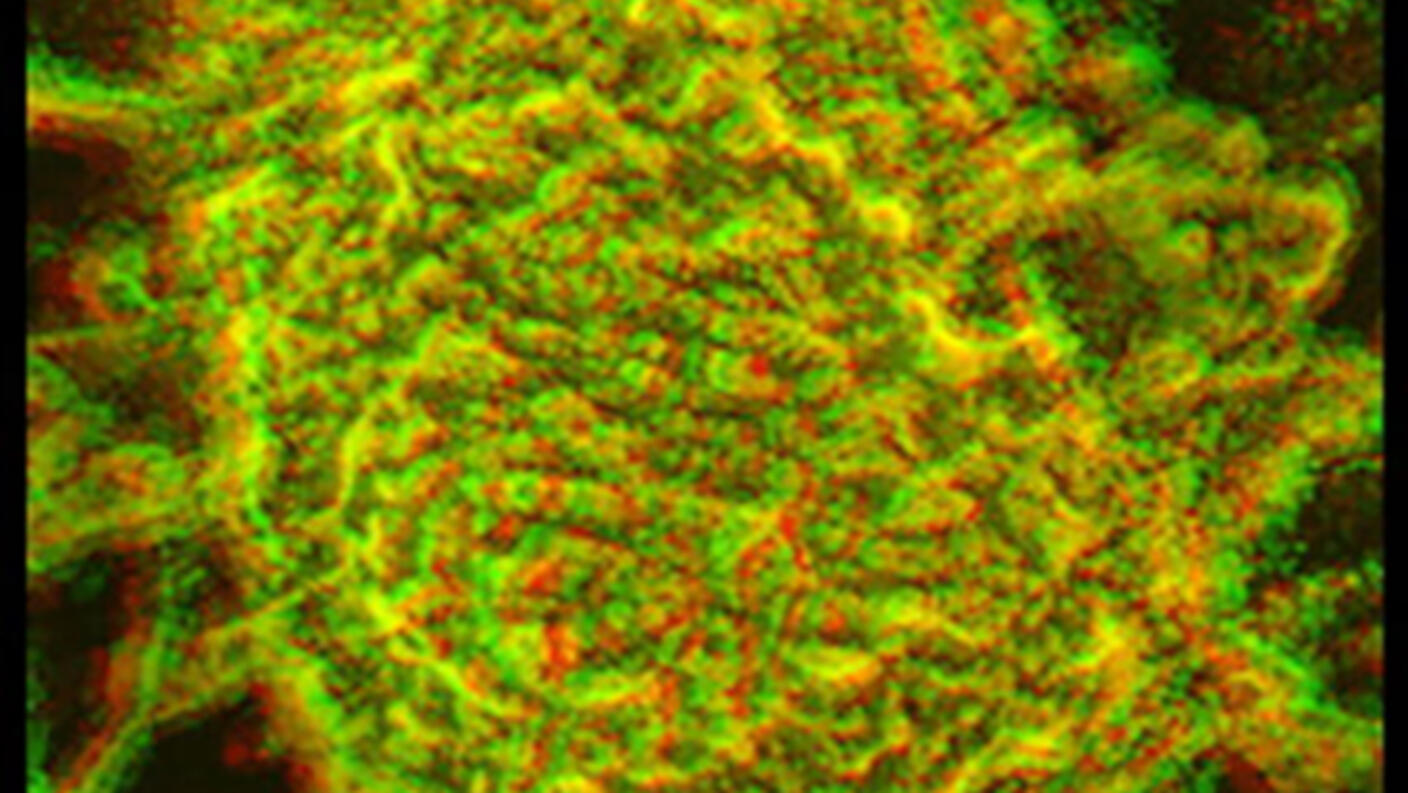 An image of a cell infected by a vaccinia virus.