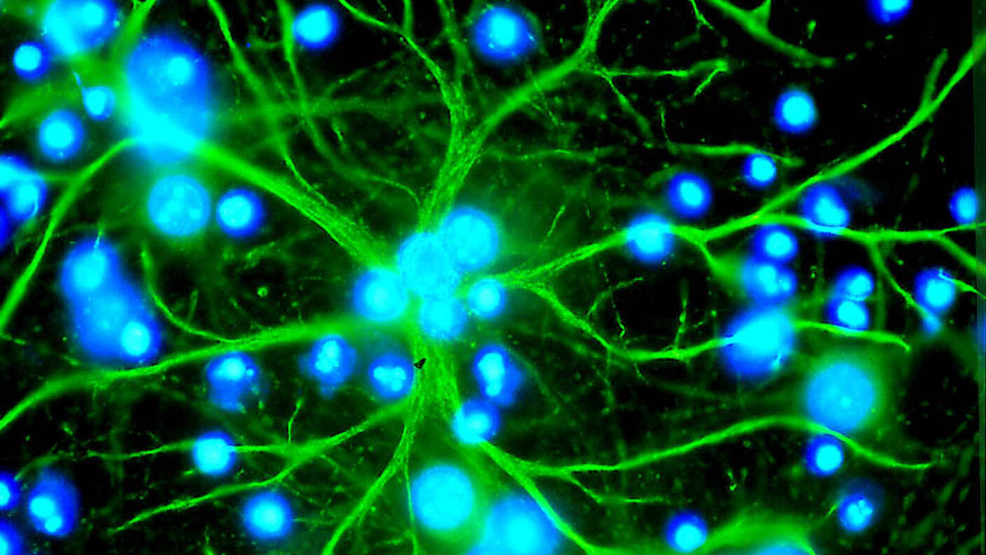 An astrocyte in culture emitting long, winding extensions.