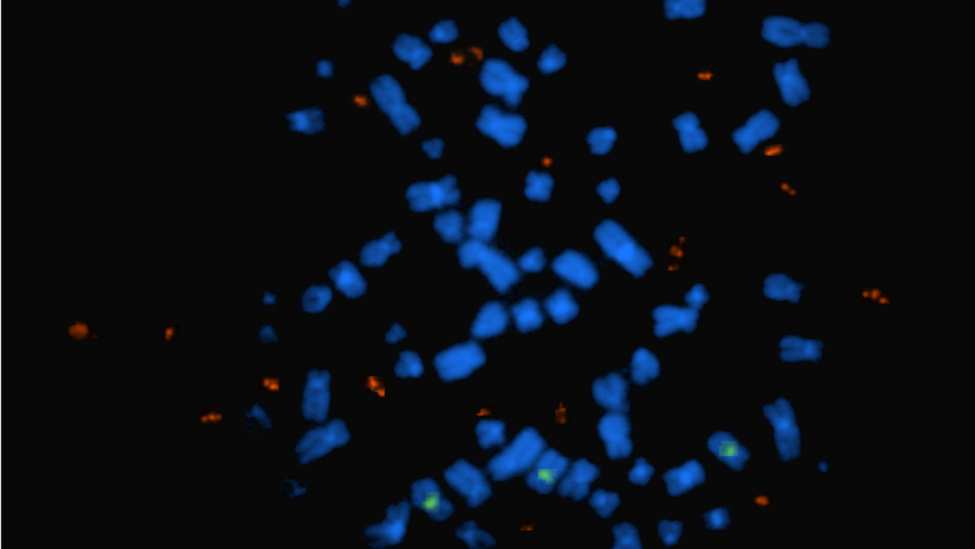 A microscopy image showing amplified EGFR in DNA circles that are separate from chromosomes.