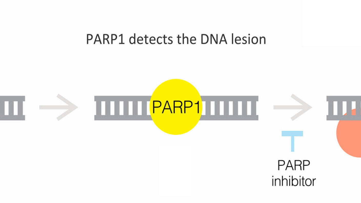 Process involving DNA repair through PARP1. It starts with a DNA strand containing a lesion, highlighted in orange. PARP1, a yellow circle, detects this DNA damage. The next step shows PARP1 attached to the DNA, signifying its role in the repair process. Nearby, a label indicates the potential use of a PARP inhibitor, shown in blue, which interferes with this repair mechanism. 