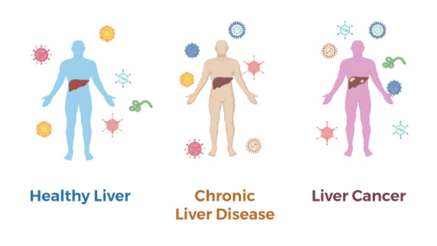 Virus particles surround three human figures with their livers highlighted. One figure has a healthy liver, one has chronic liver disease and one has liver cancer.