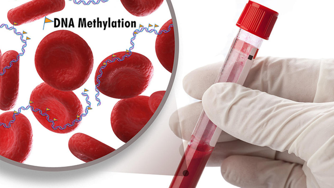 Person holding tube of blood with closeup showing DNA methylation