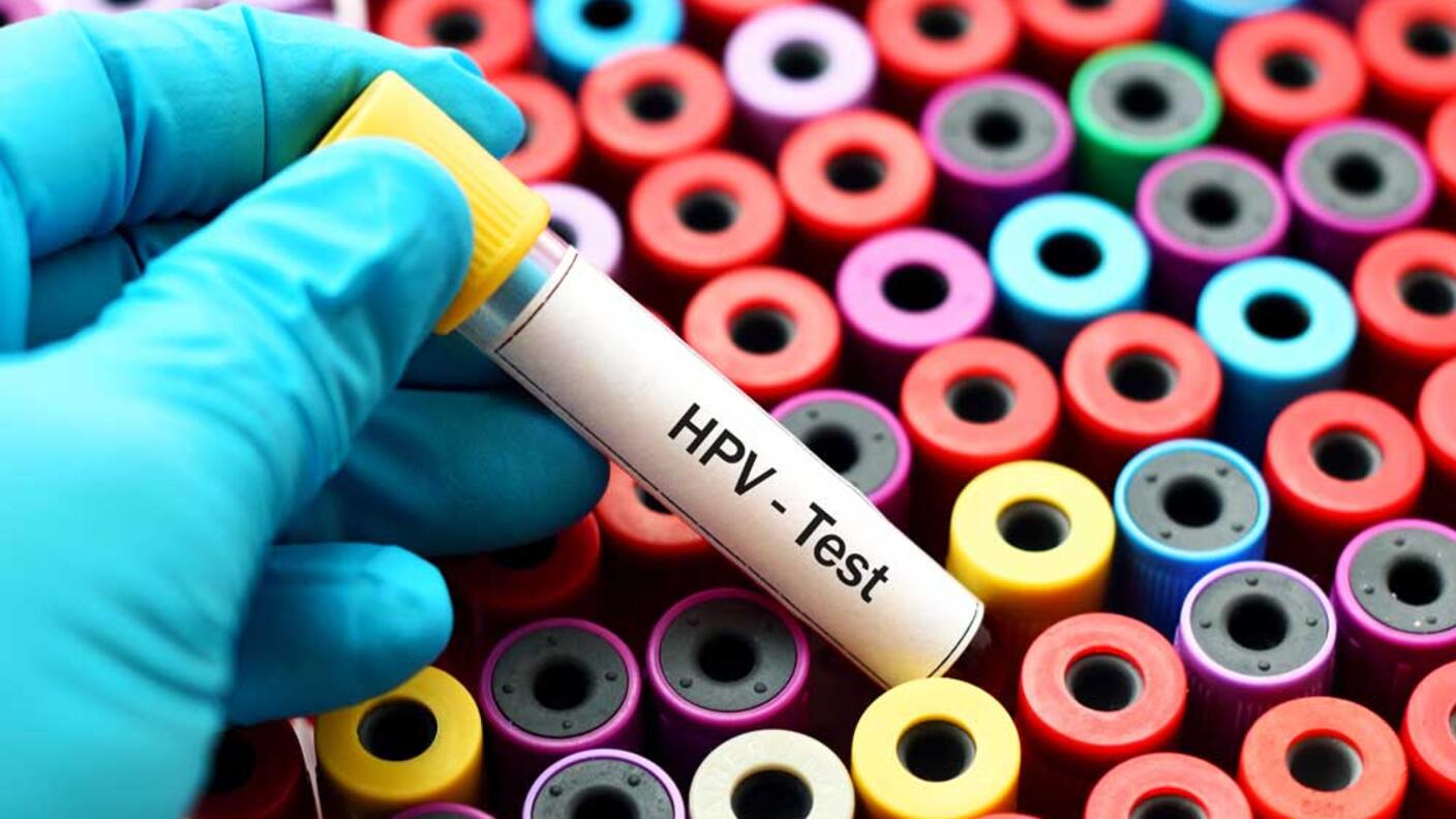 A gloved hand holding a blood collection tube labeled 'HPV-Test' over a rack of colorful blood collection tubes with various colored caps.