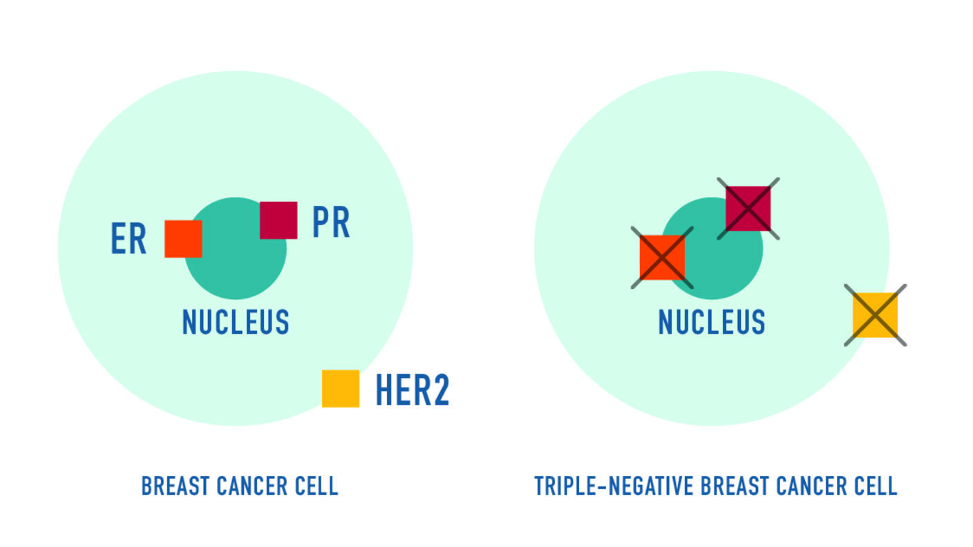 A simplified graphic of two blue cancer cells. On the left, the cell has three receptors highlighted--two in the nucleus and one on the cell's edge.  On the right, these receptors have X symbols over them.