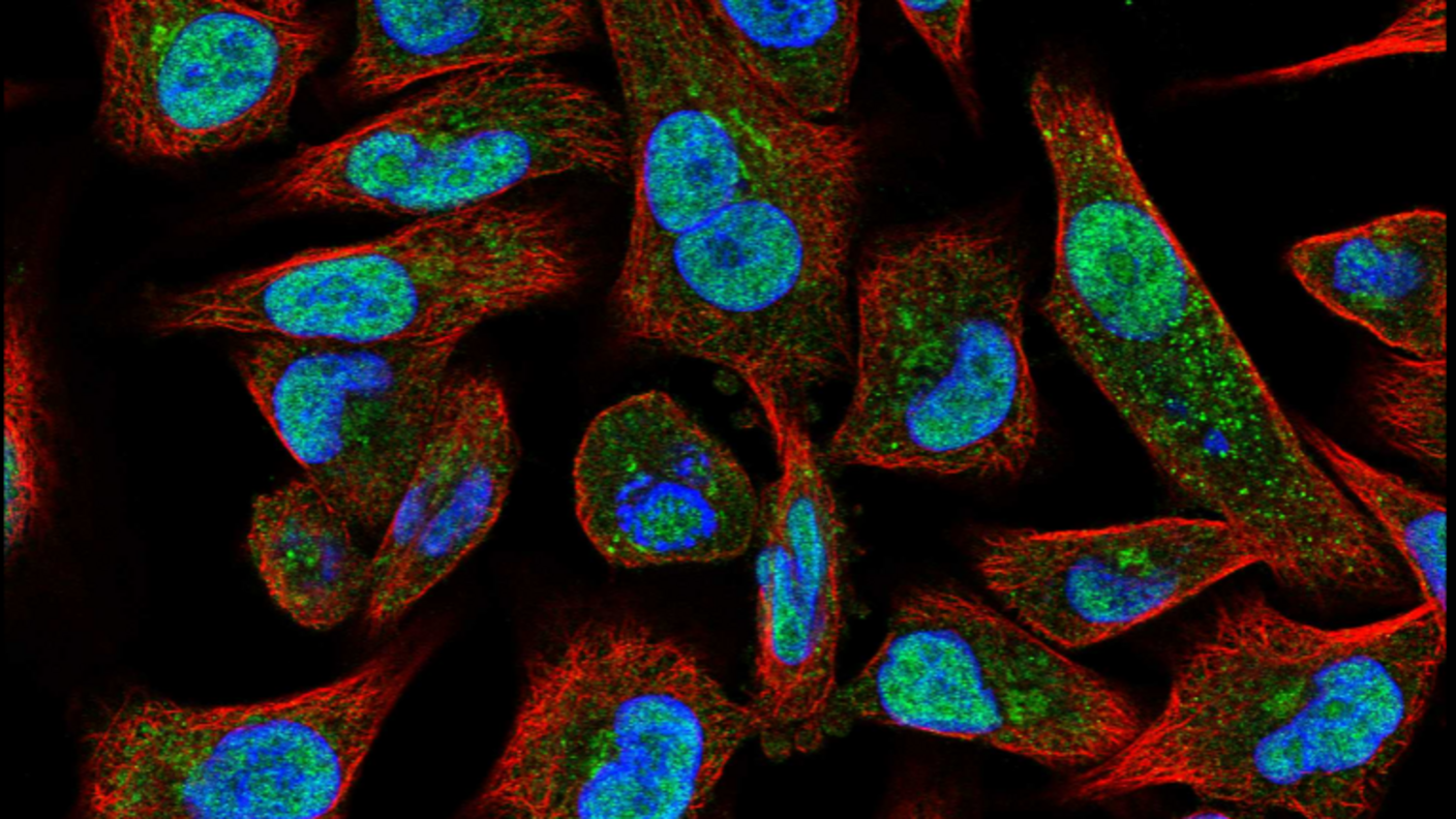 Image of cells with POLQ stained green.