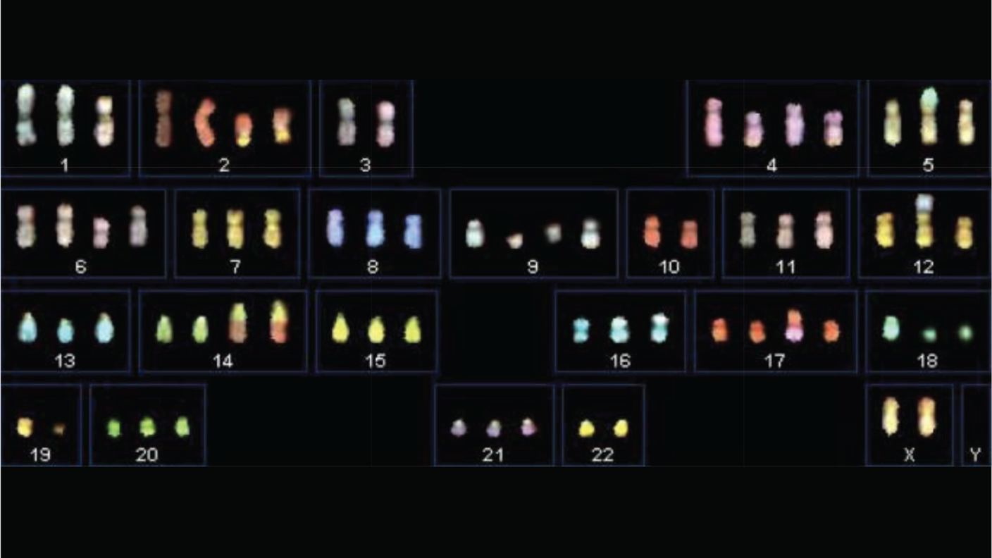 A process called spectral karyotyping shows widespread aneuploidy in a cell line of lung cancer.