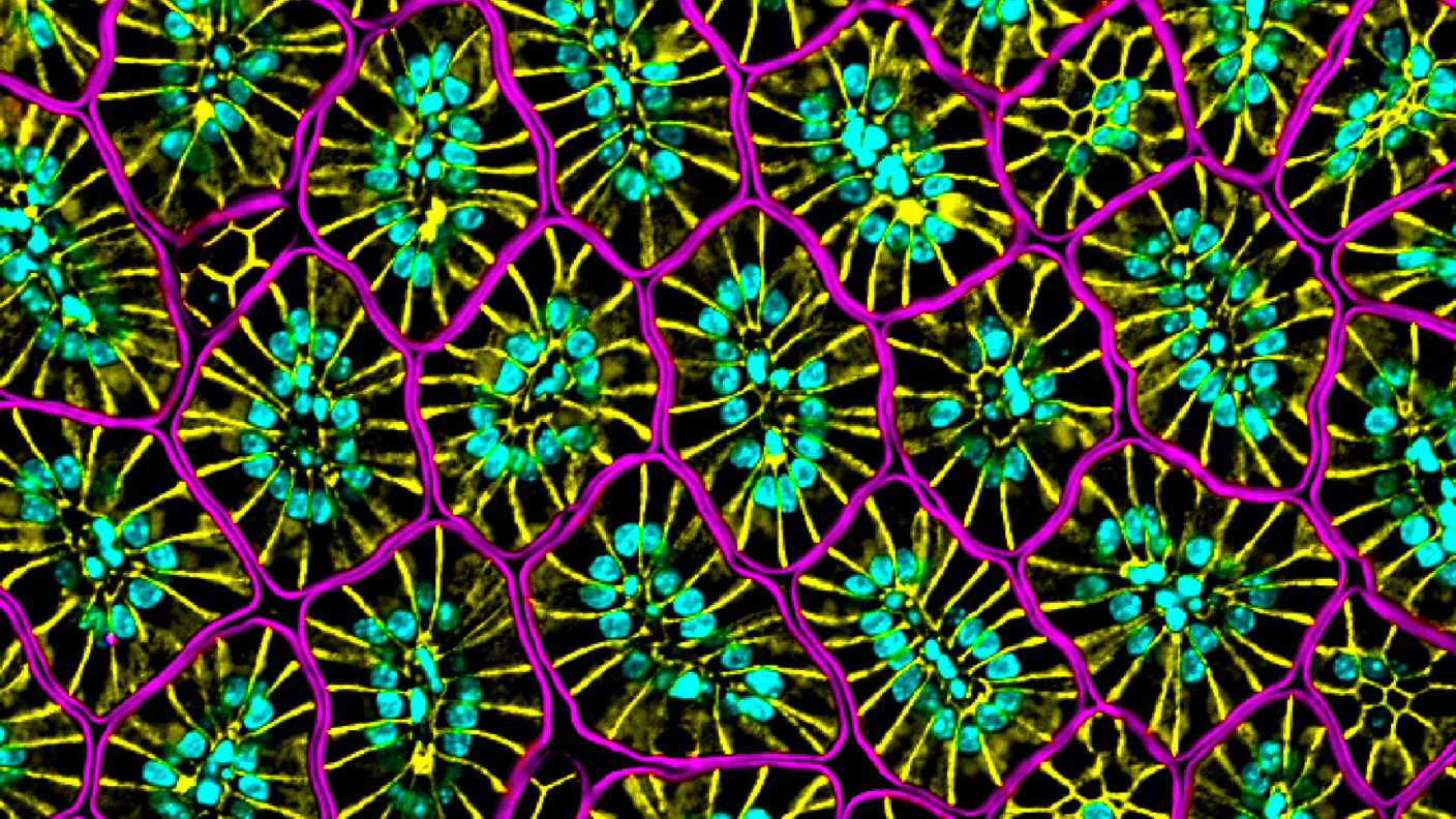 A microscopic cross section of intestinal villi