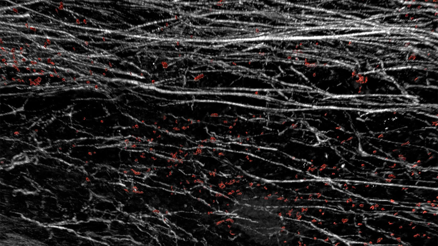 Image of white fiber structures and red cells on black background