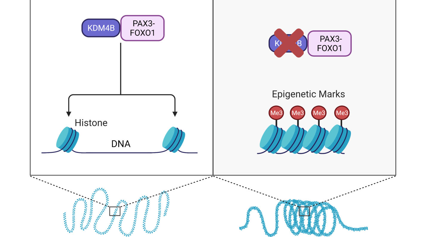 An illustration with two panels. On the left, PAX3-FOXO1 interacts with KDM4B in front of stretched-out DNA. On the right, KDM4B is crossed out and the DNA is wound up.