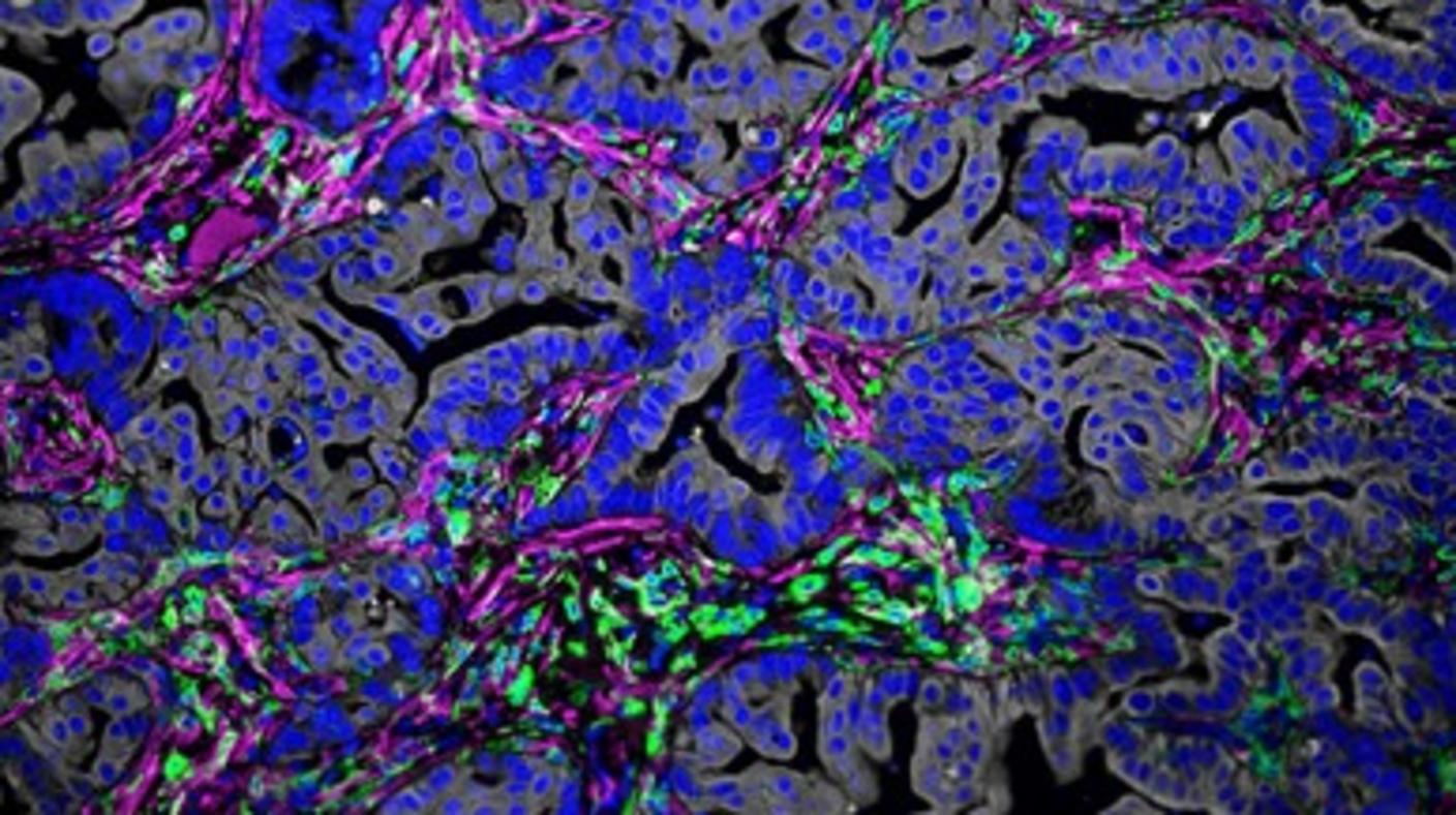 Two microscopic images are shown, each displaying complex cellular structures and tissues. The top image features a network of cells and fibers mostly in blue, green, and purple, with some areas highlighted in pink. The bottom image also shows a dense arrangement of cells and fibers with similar staining, but presents a different pattern and distribution of the colored elements.