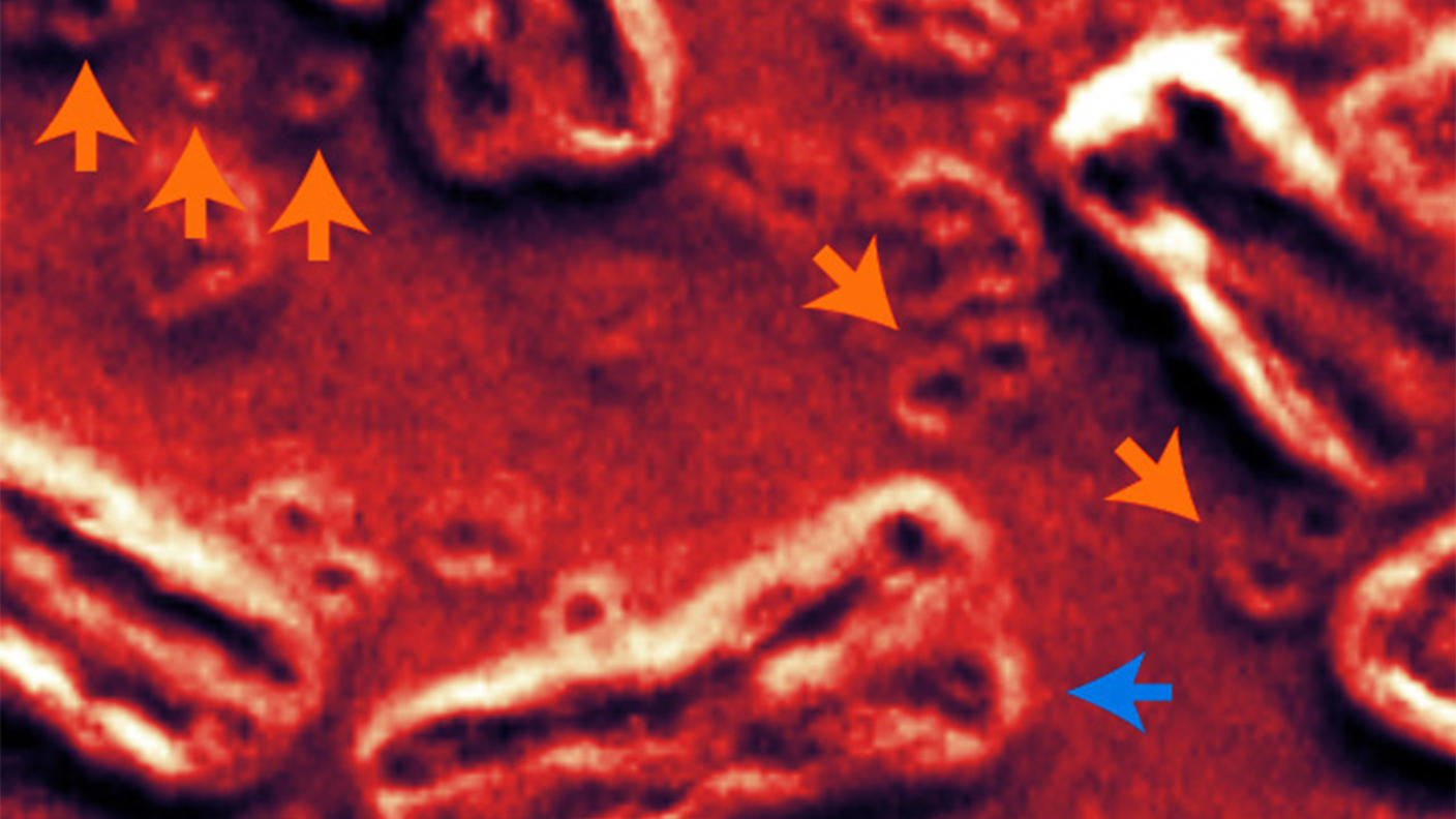 A scanning electron micrograph showing chromosomes and ecDNA