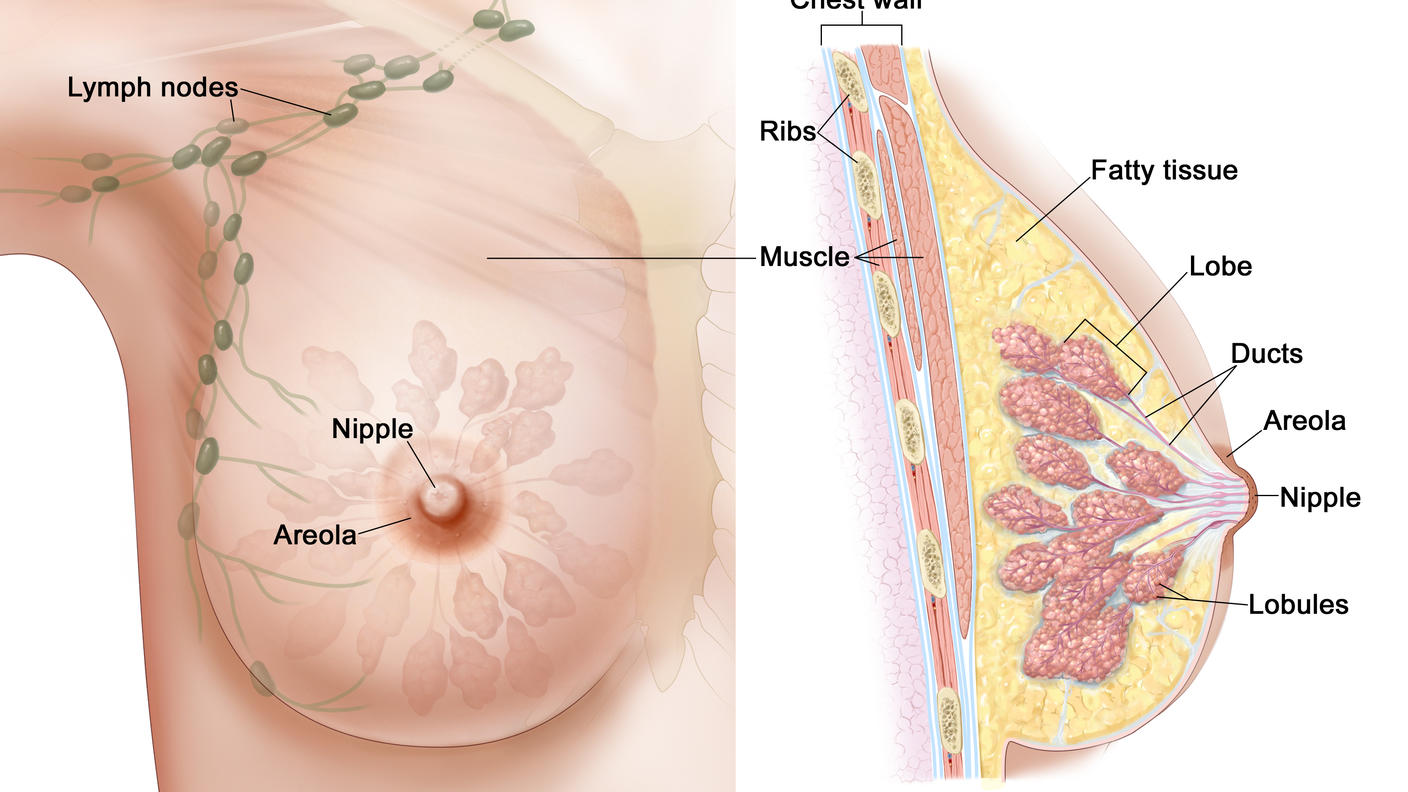 Illustration of the female breast anatomy. On the left, a front view shows lymph nodes inside the breast going from the breast to the armpit. On the right, a cross-section shows the chest wall, ribs, fatty tissue, lobes, ducts, and lobules. Also shown in both panels are the muscle, nipple, and areola.