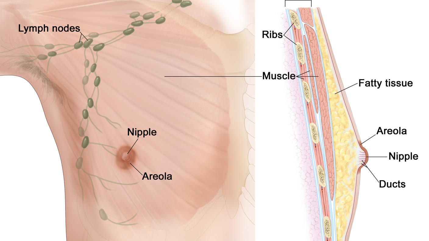 Drawing of male breast anatomy showing the lymph nodes, nipple, areola, chest wall, ribs, muscle, fatty tissue, and ducts.