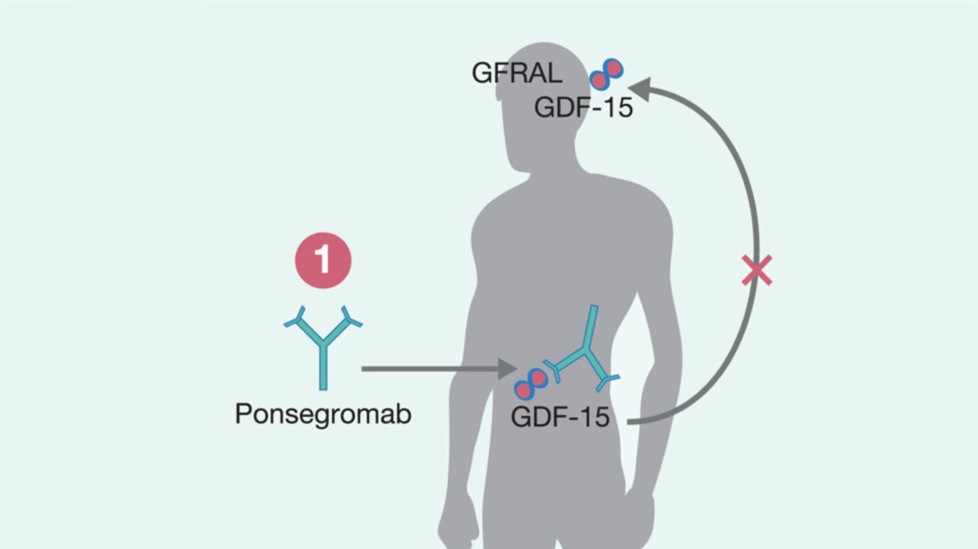 Silhouette of a human body showing Ponsegromab's biological mechanism of action.