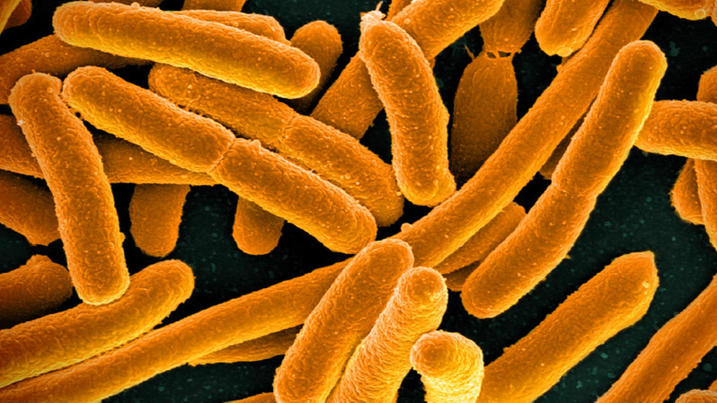 A scanning electron micrograph of E. coli, with the rod-shaped bacteria colored a mustard yellow.